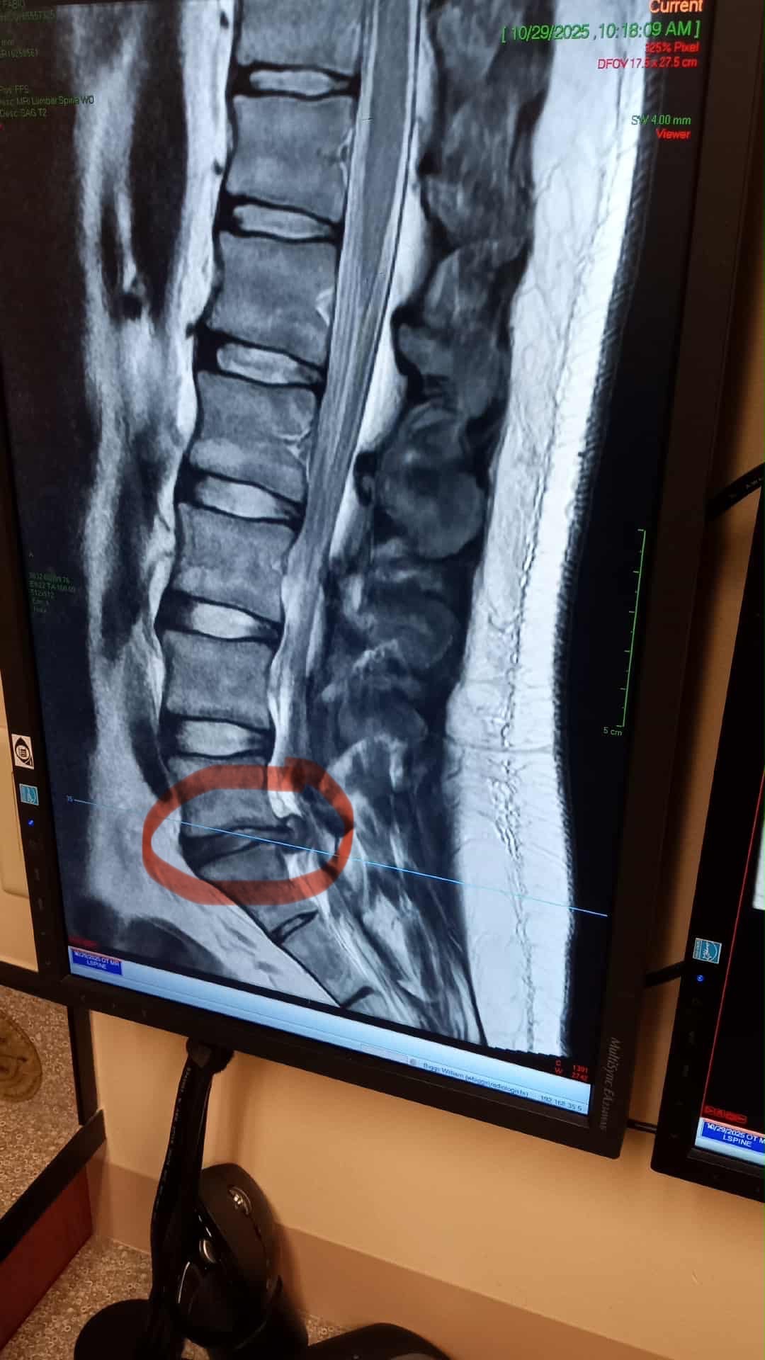 Help Fabio Vasquez and his Family Recover from Severe Injury campaign photo, 4 of 5