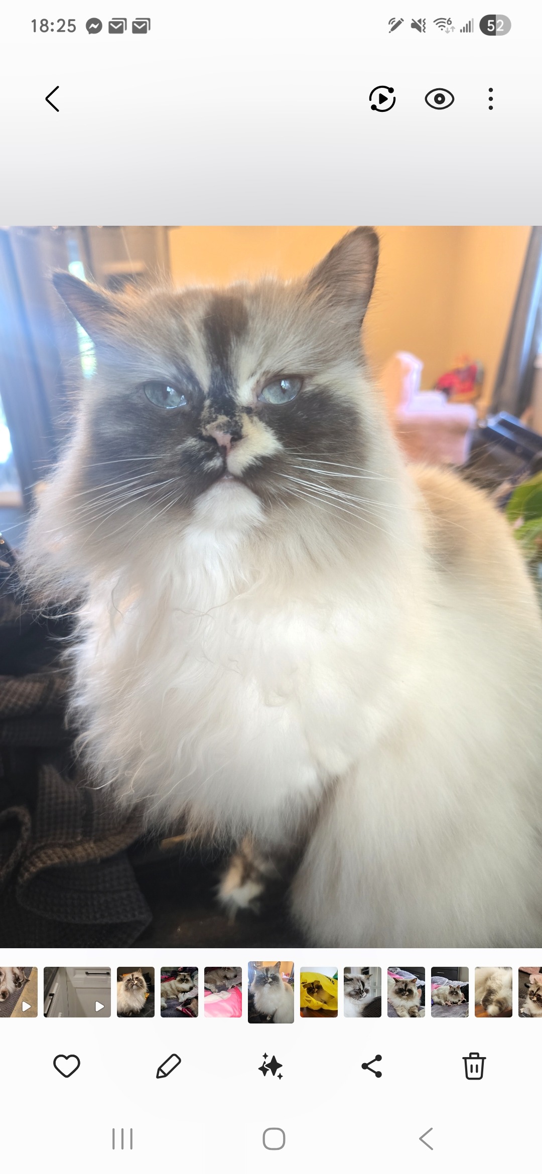 Callie's Jaw Surgery campaign photo, 5 of 6