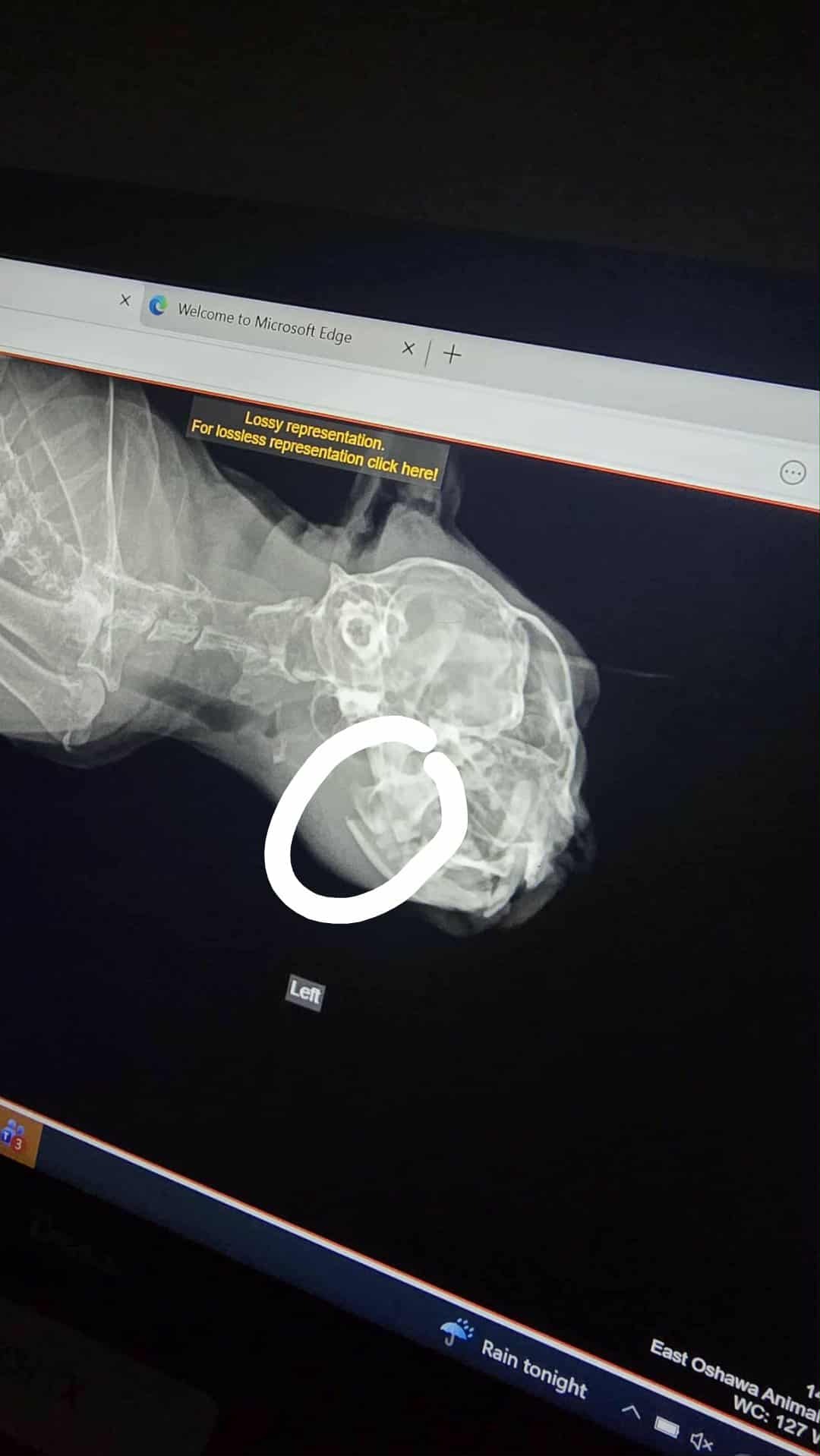 Callie's Jaw Surgery campaign photo, 4 of 6