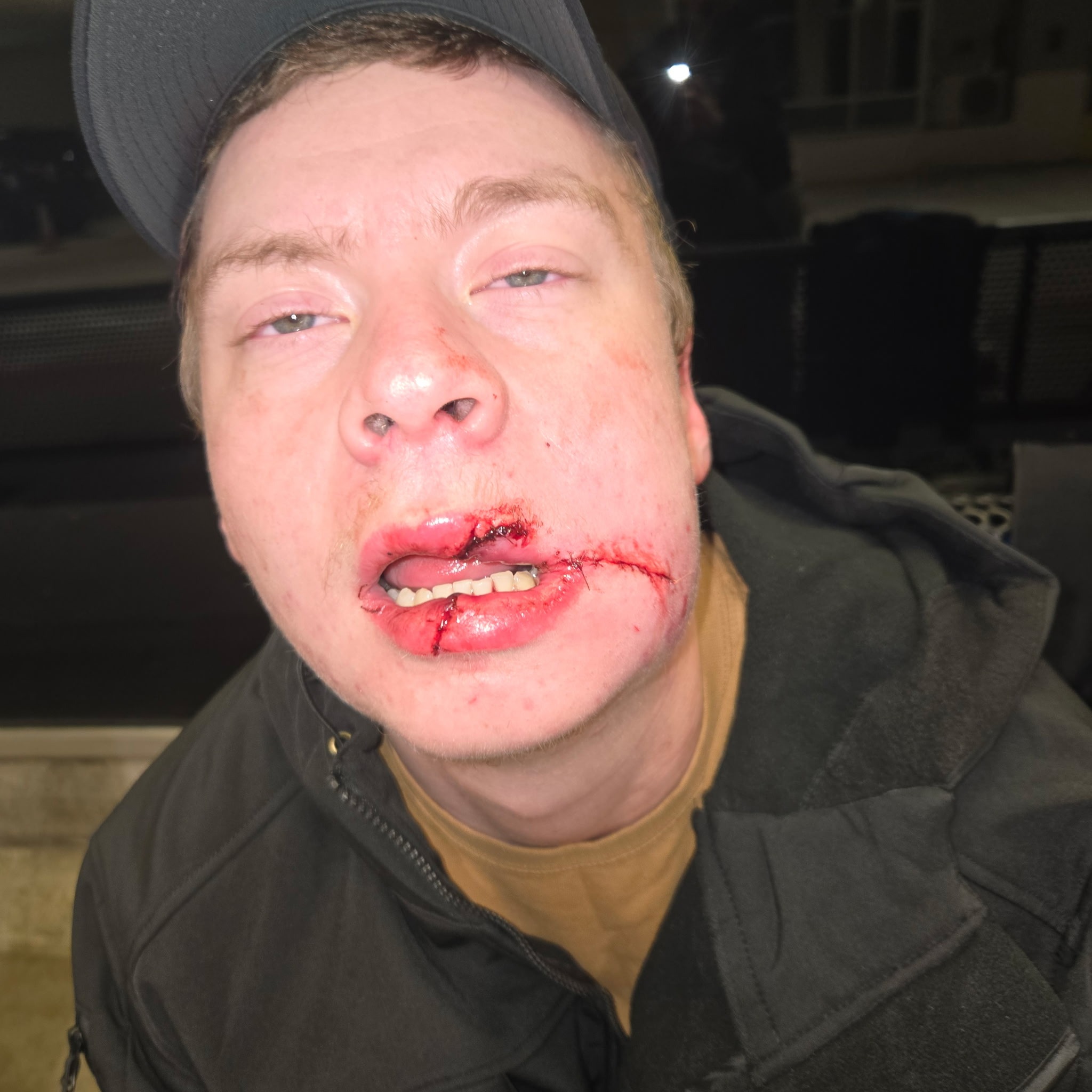 Support Keith Scott’s Recovery After a Serious Accident campaign photo, 4 of 5