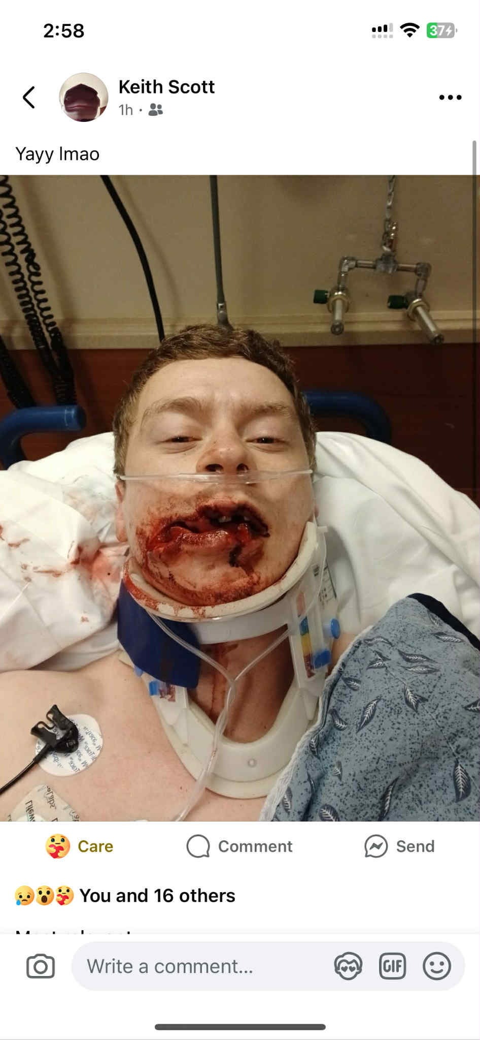 Support Keith Scott’s Recovery After a Serious Accident campaign photo, 2 of 5