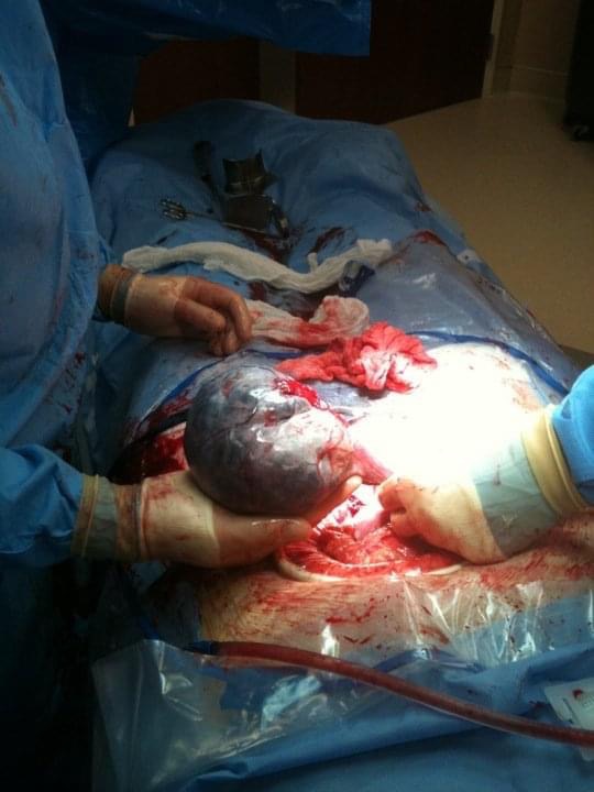 Aid Courtney's Fight Against Rapidly Growing Tumors campaign photo, 2 of 4
