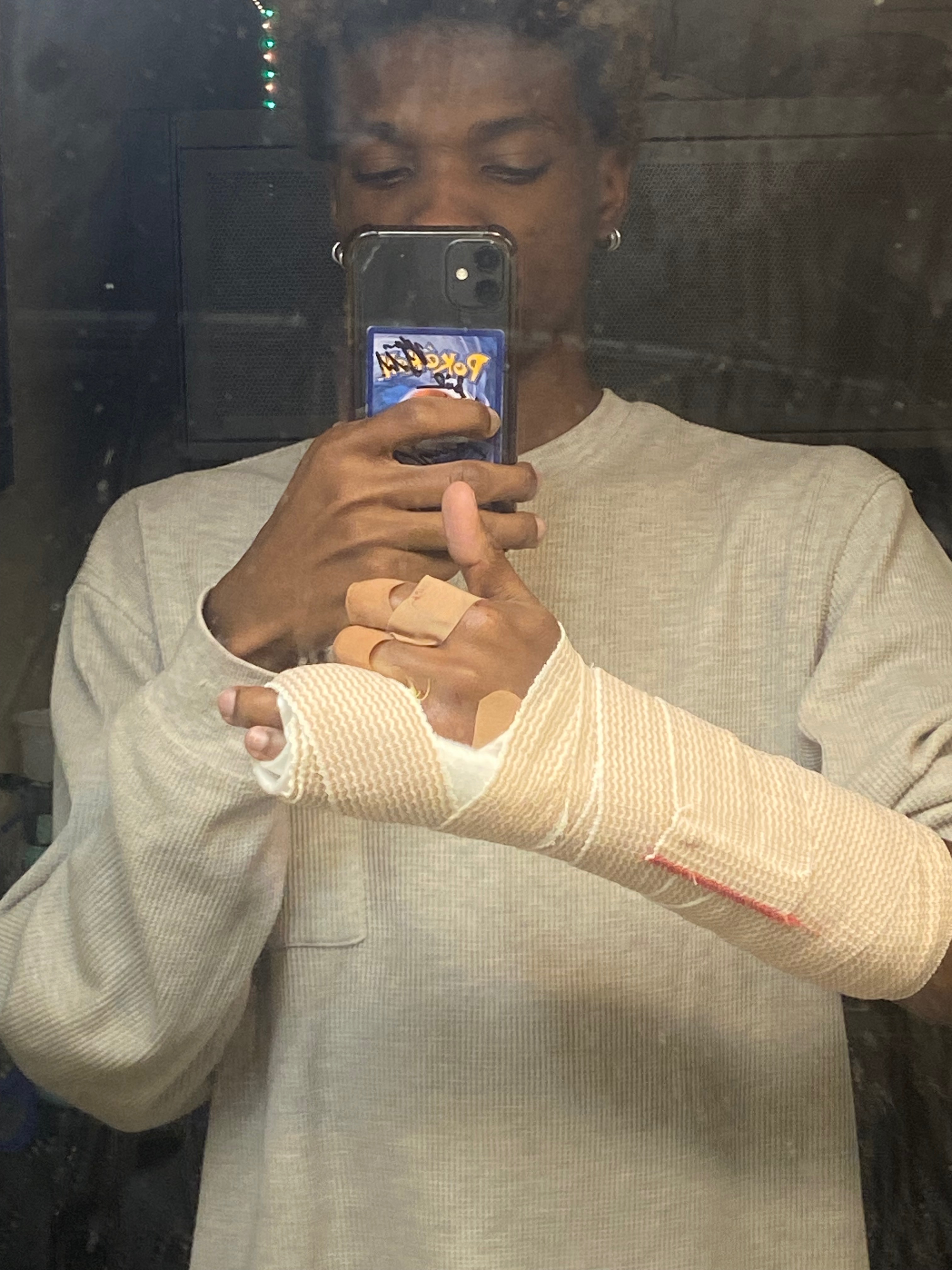 Help Heal My Hand campaign photo, 2 of 5