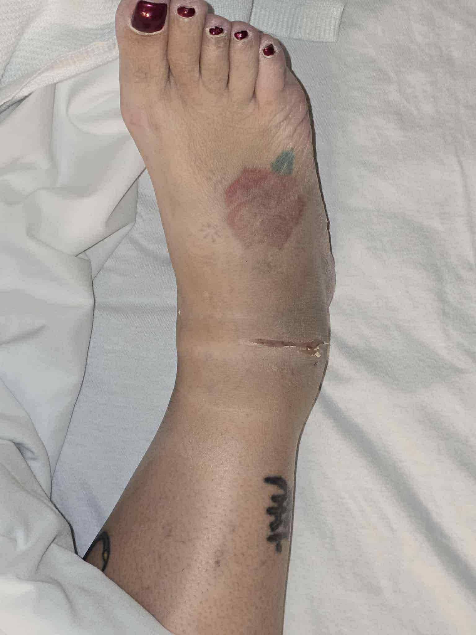 Support for Family After Severe Car Accident campaign photo, 2 of 8