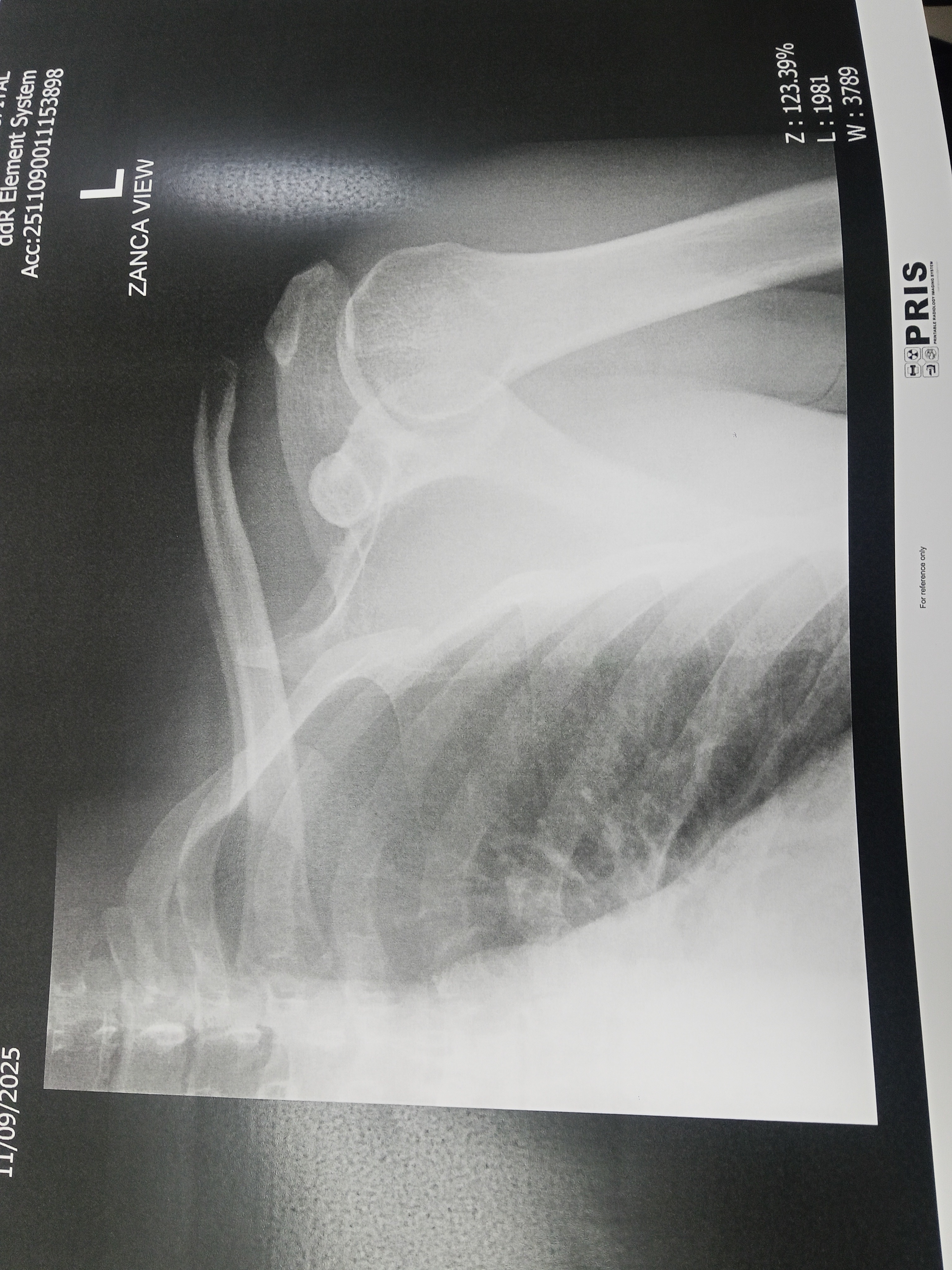 Support Needed for Urgent Shoulder Surgery campaign photo, 2 of 4