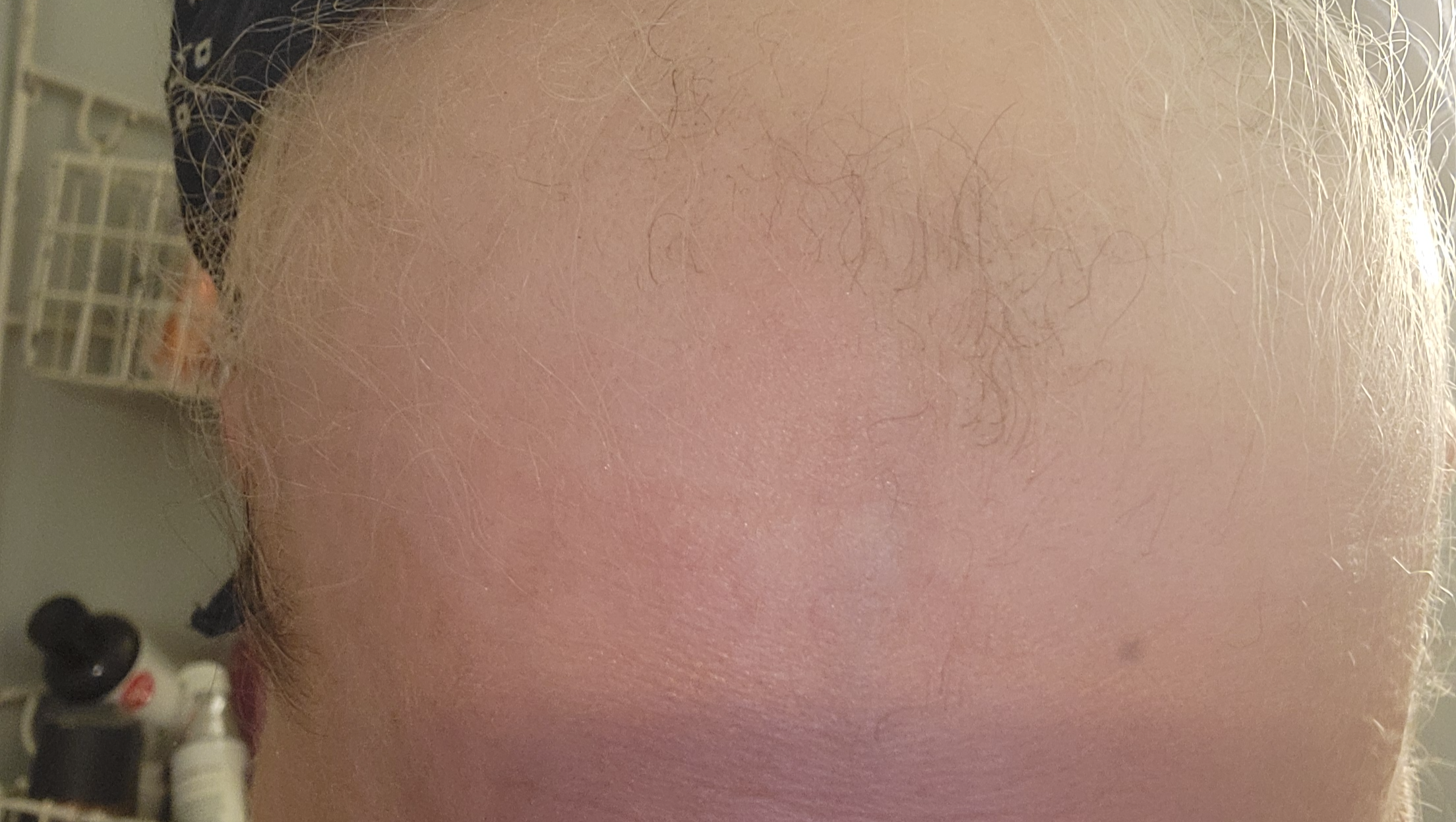 Support a Brave Parent's Journey to Normalcy photo