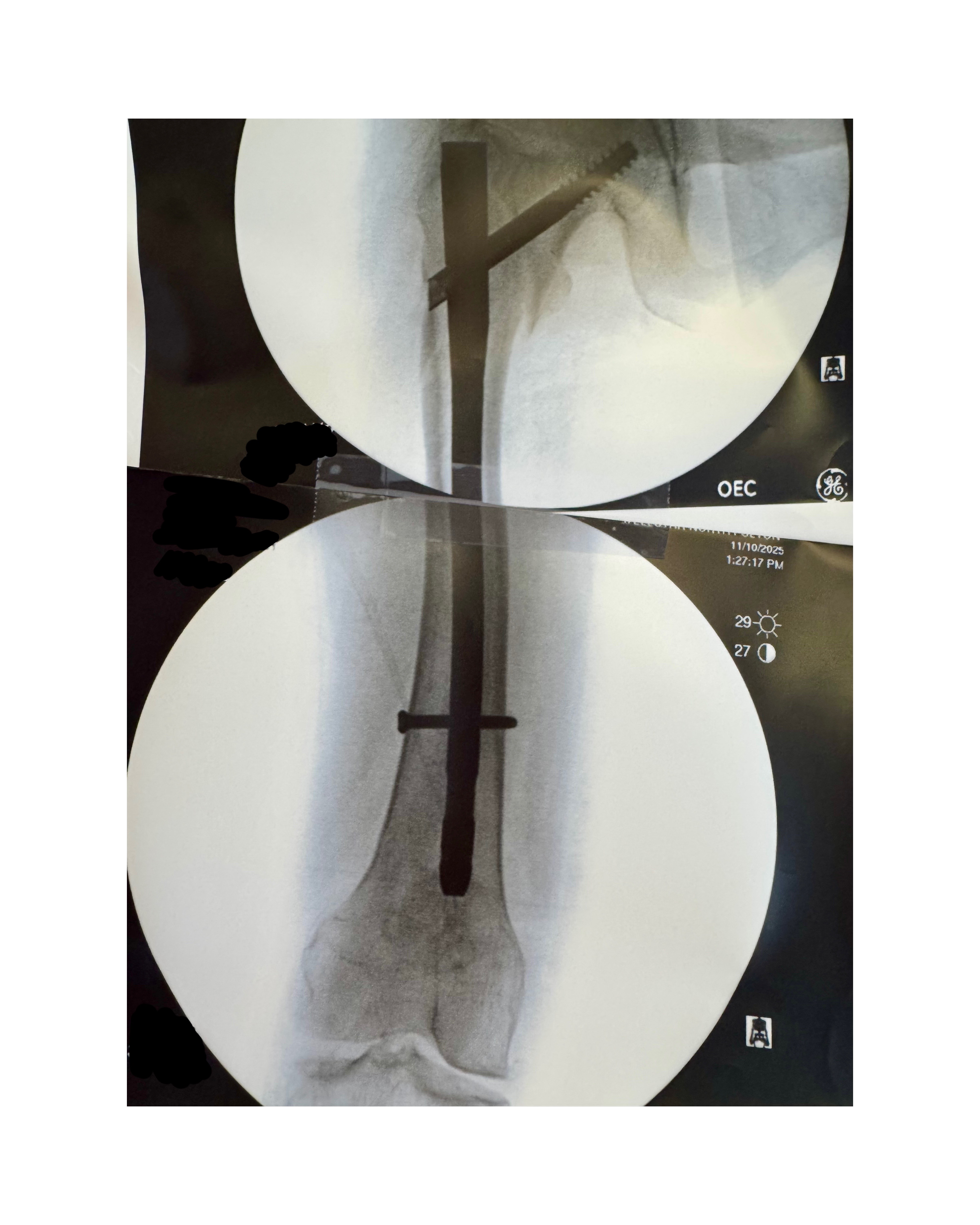Support Sherri’s Hip Surgery Recovery campaign photo, 2 of 4