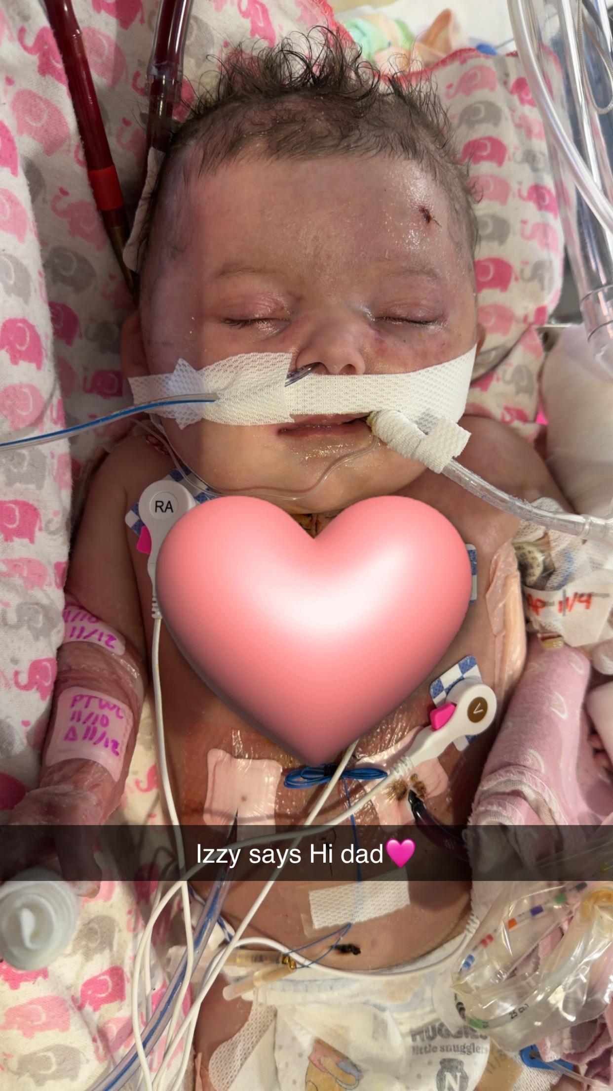Support Baby Isabella's Recovery Journey campaign photo, 2 of 8