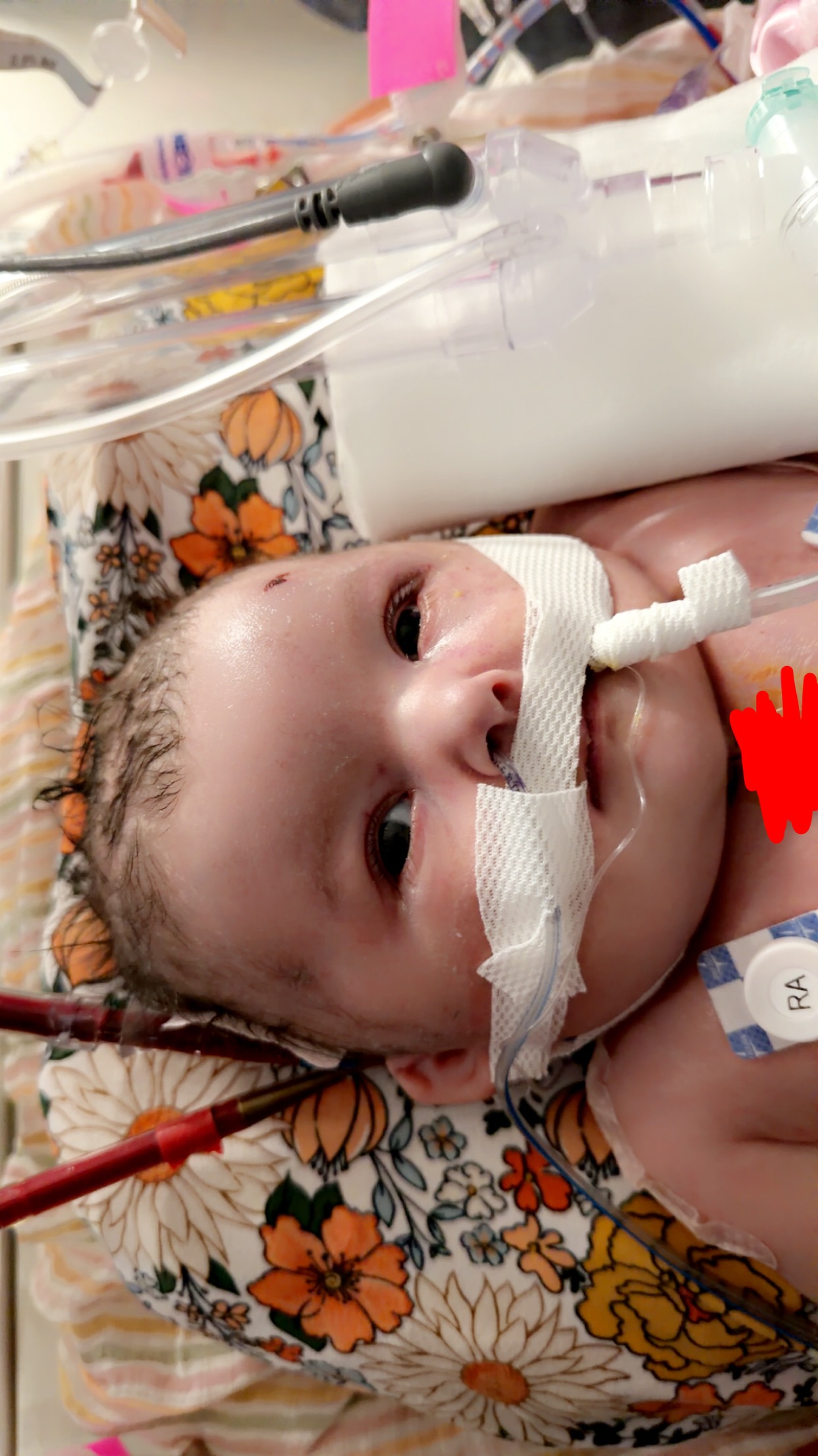 Support Baby Isabella's Recovery Journey campaign photo, 4 of 8