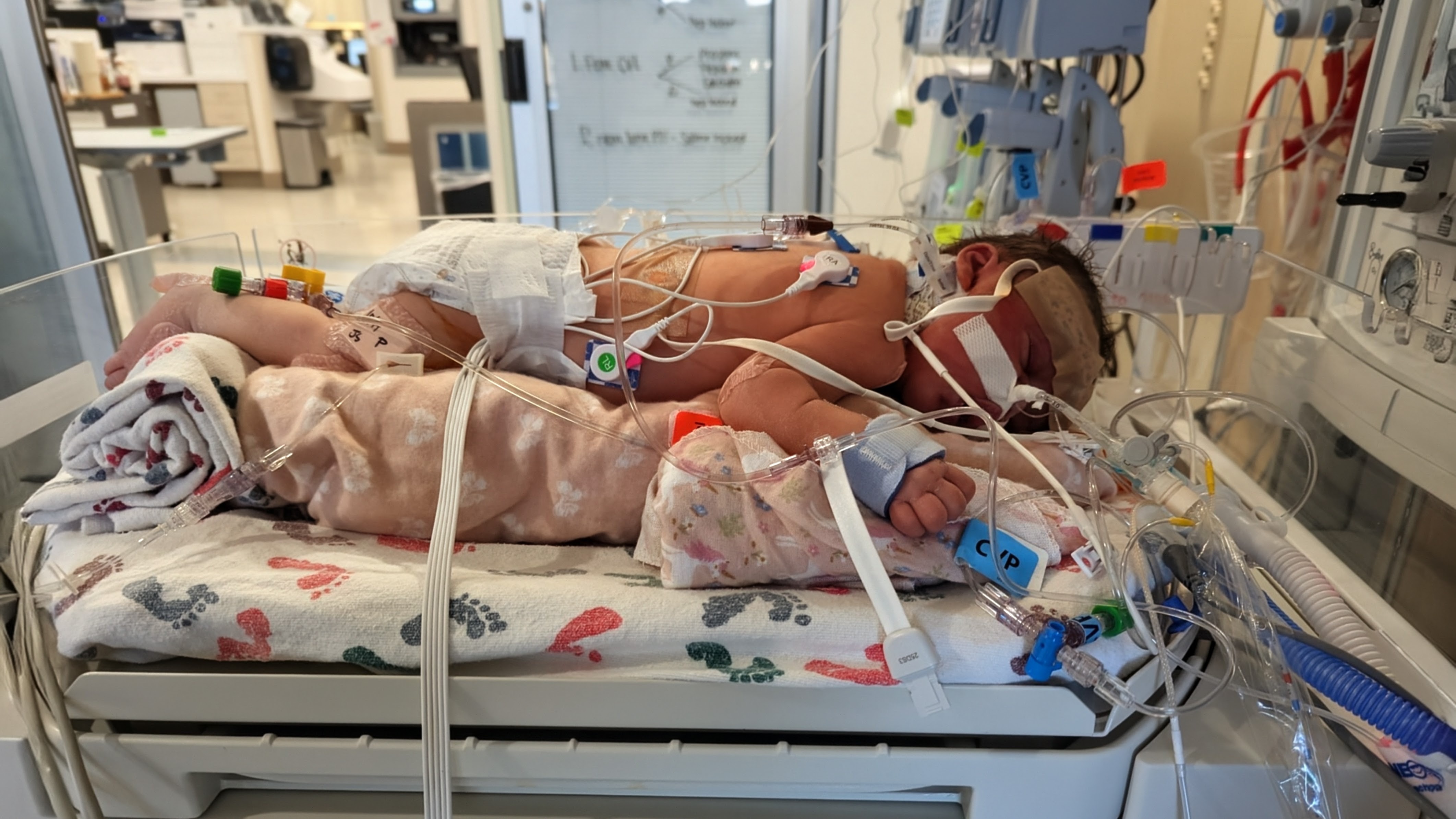 Support Baby Isabella's Recovery Journey campaign photo, 6 of 8