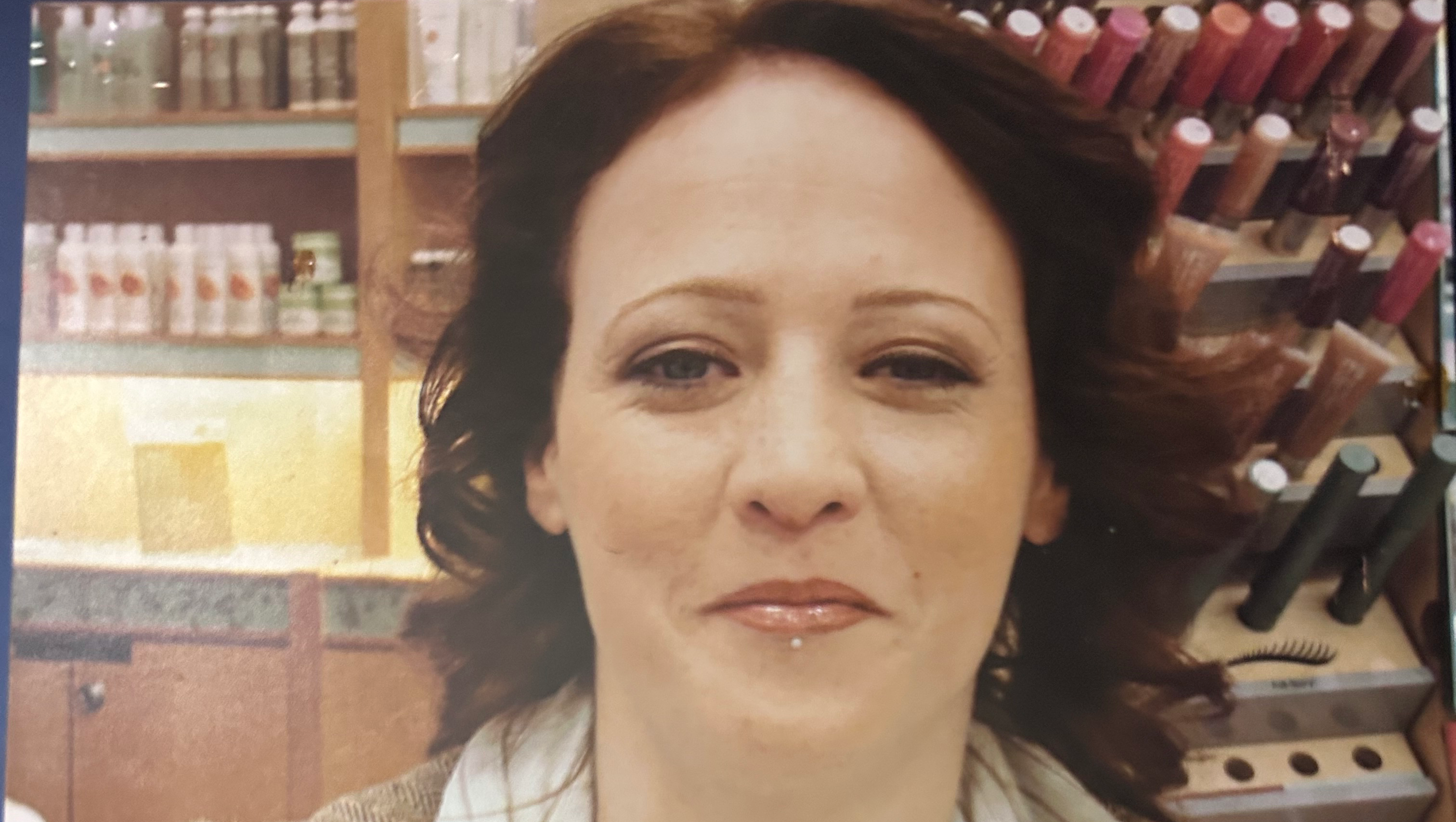 Jacqueline Renee Reddon. Had Life threatening seizures photo