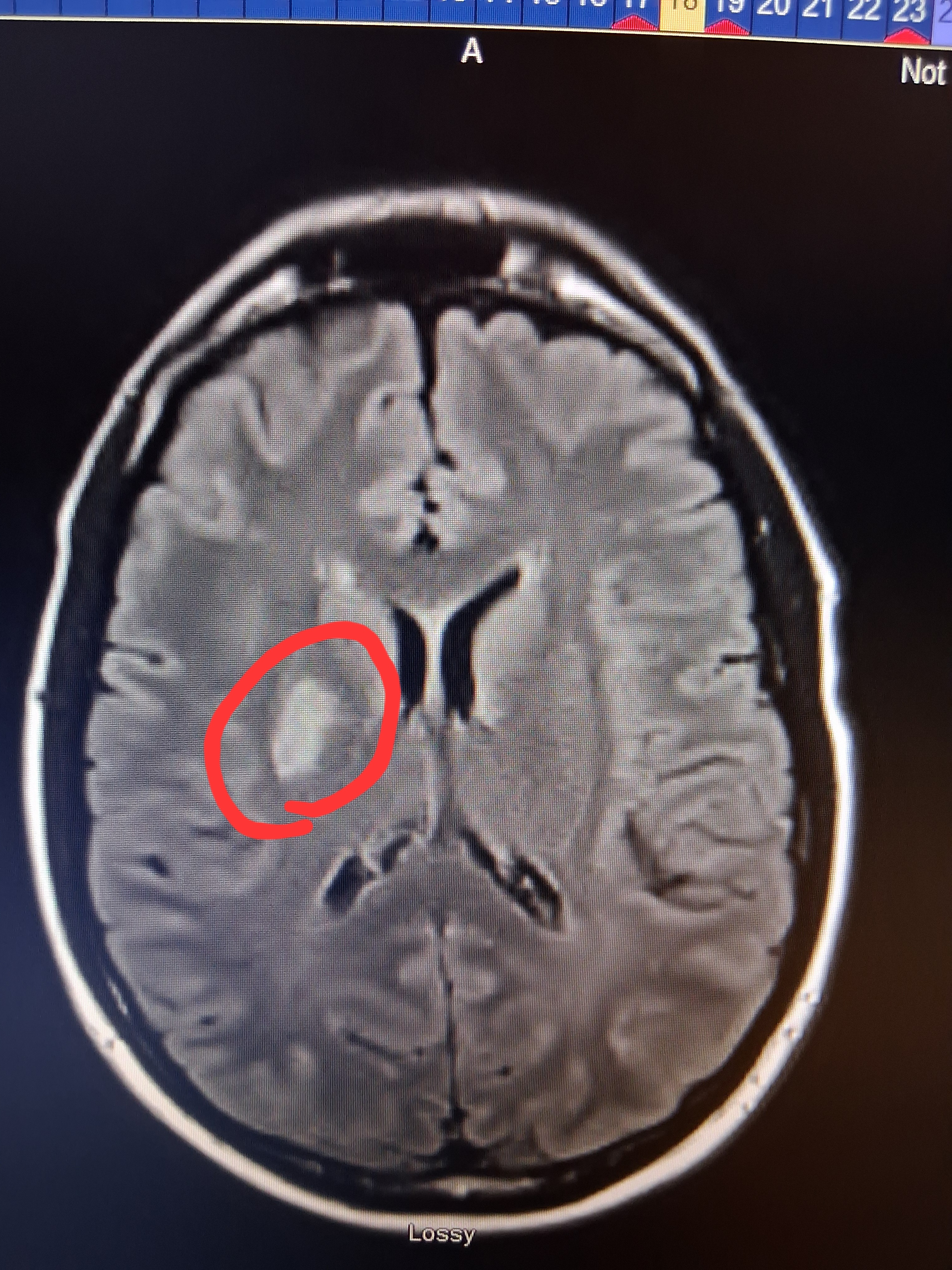 Support Mark & Rachel's Family After Stroke Crisis campaign photo, 4 of 6