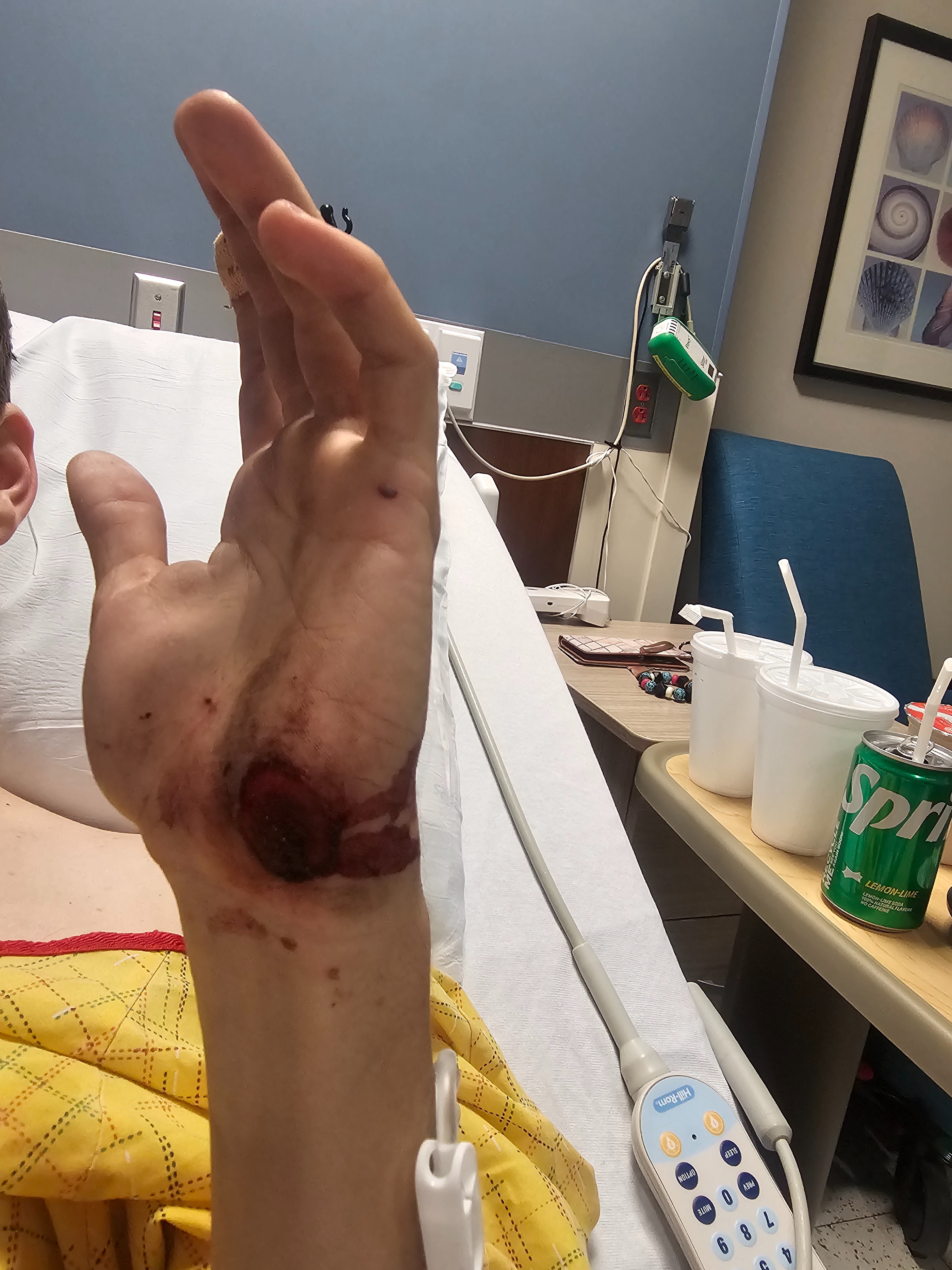 Help Keelen Heal: Medical and Rehab Costs campaign photo, 4 of 7
