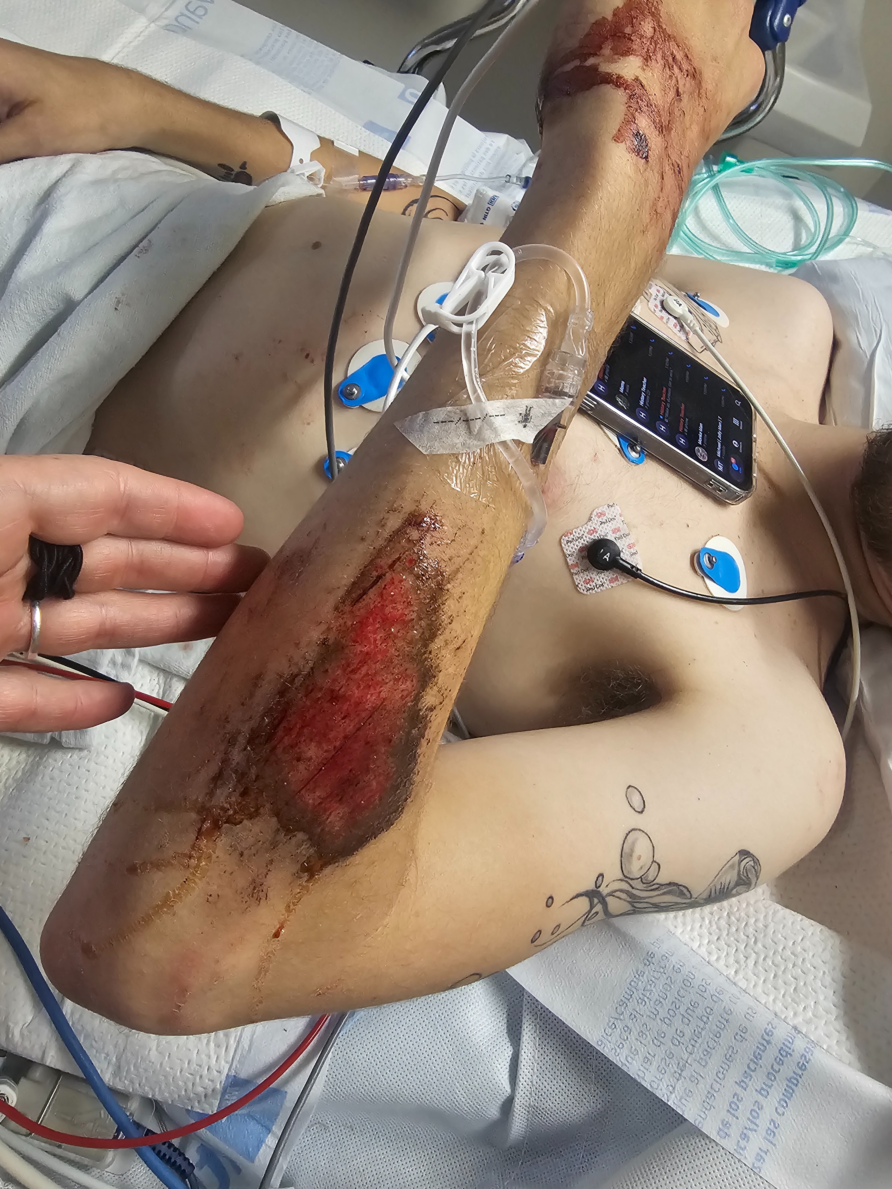 Help Keelen Heal: Medical and Rehab Costs campaign photo, 5 of 7