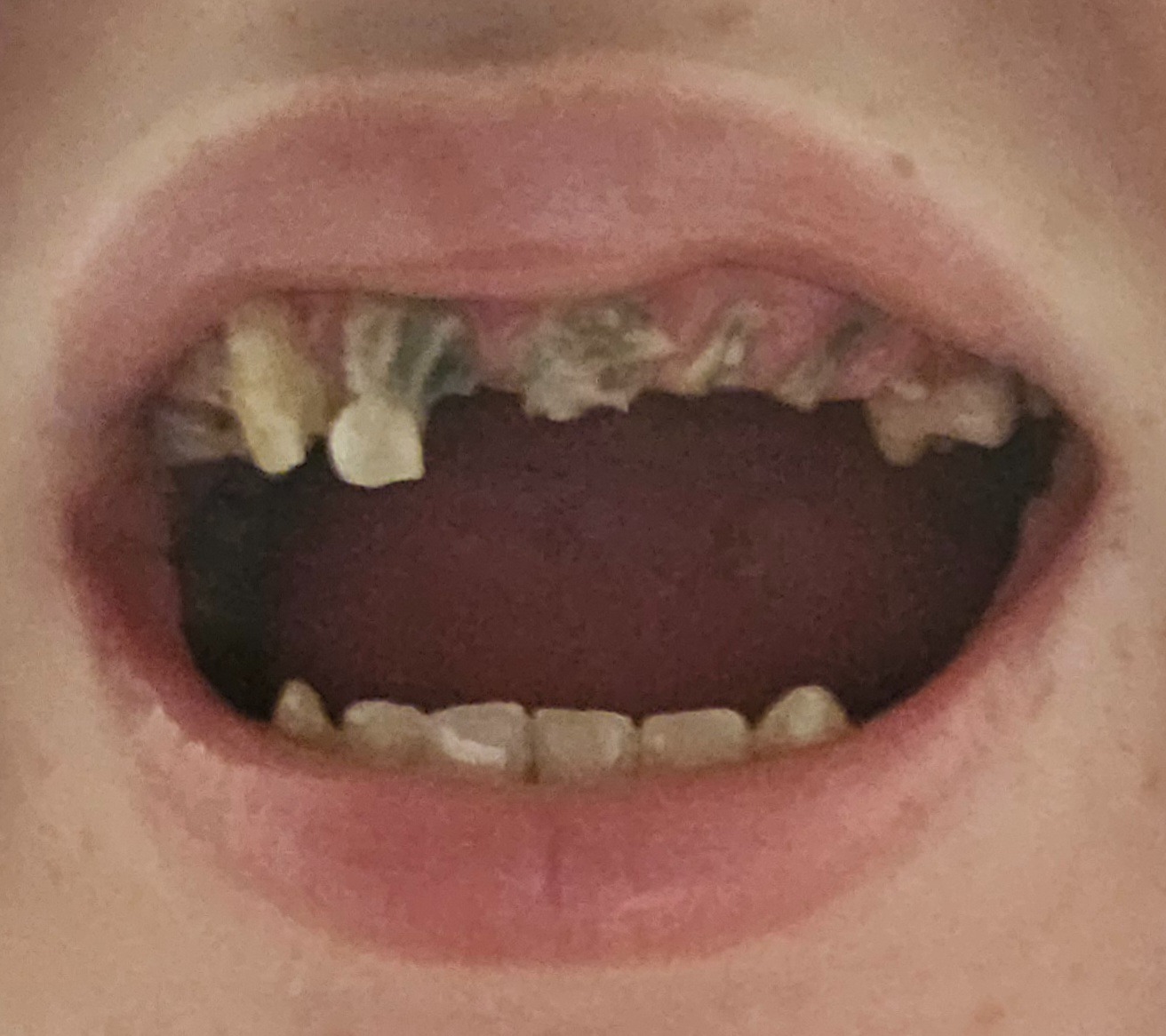 Restore a Smile: Help a Mother in Need campaign photo, 2 of 8