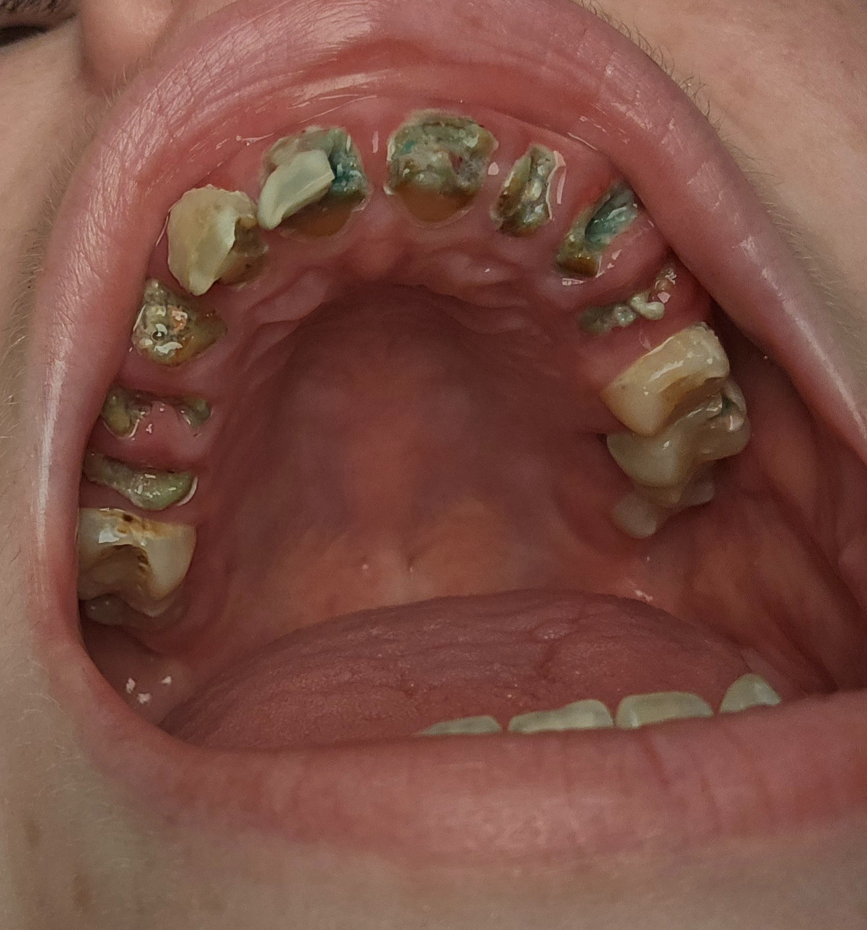 Restore a Smile: Help a Mother in Need campaign photo, 5 of 8