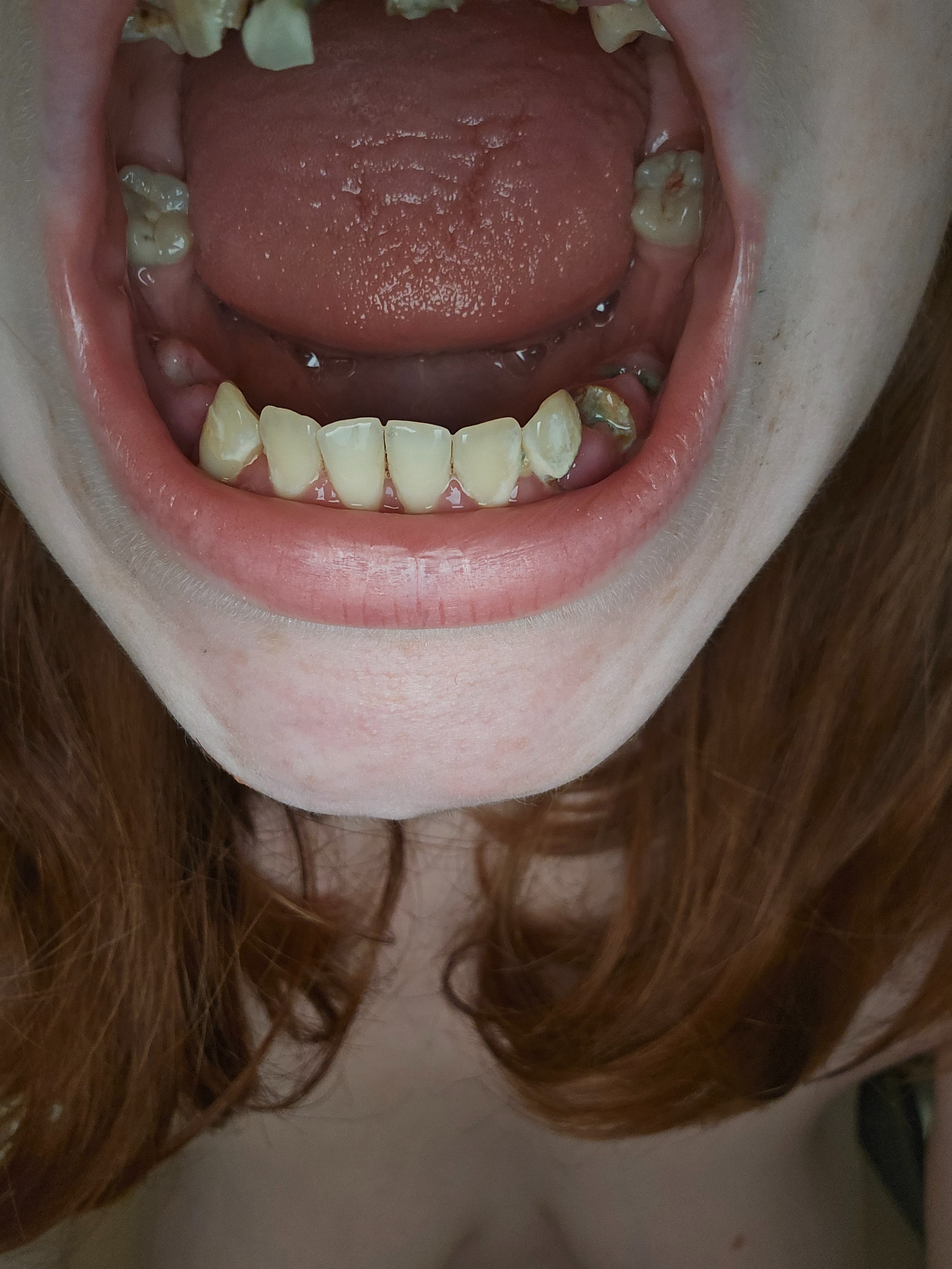 Restore a Smile: Help a Mother in Need campaign photo, 6 of 8