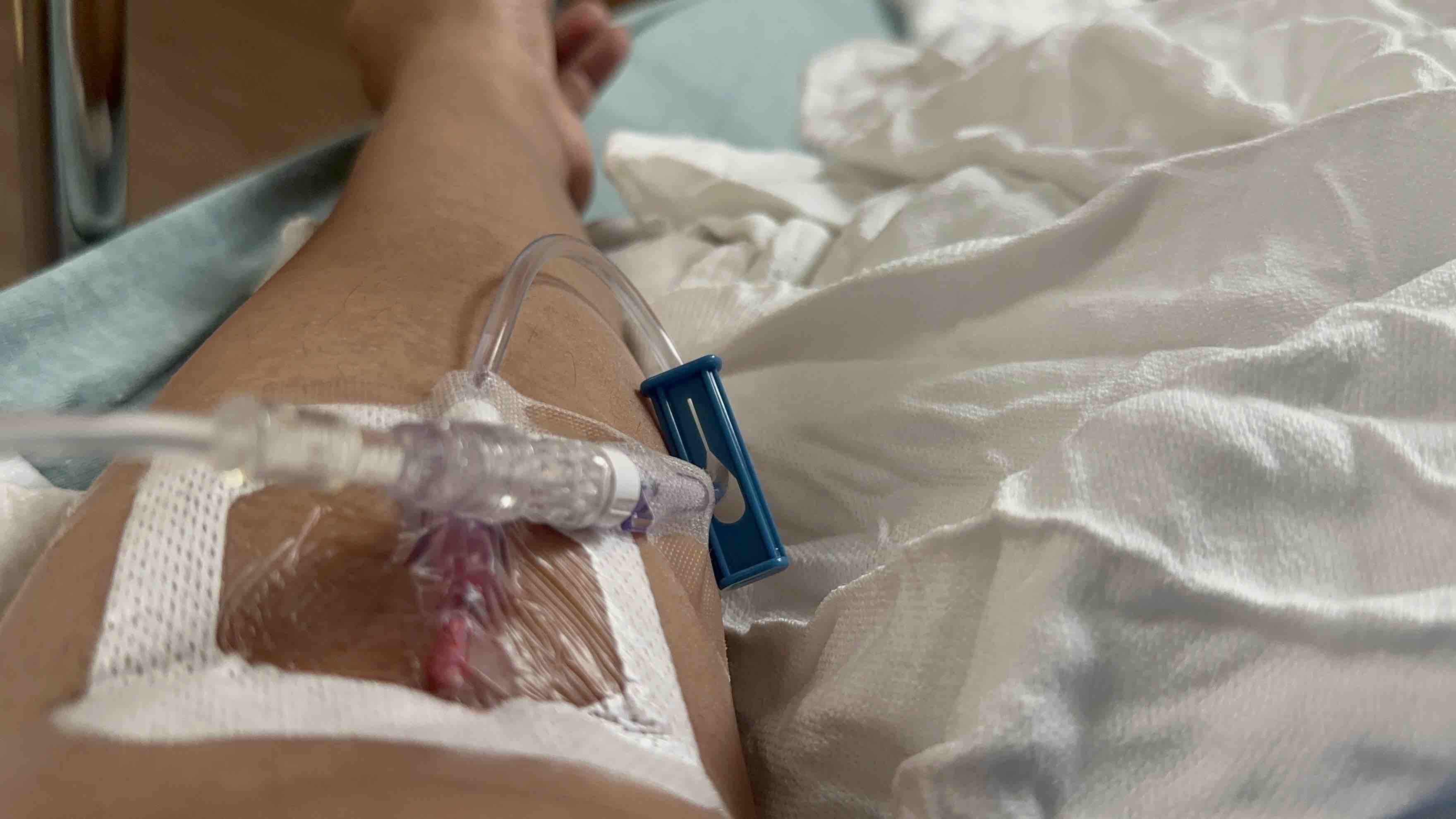 Help me stage IV cancer: High risk liver surgery campaign photo, 5 of 7