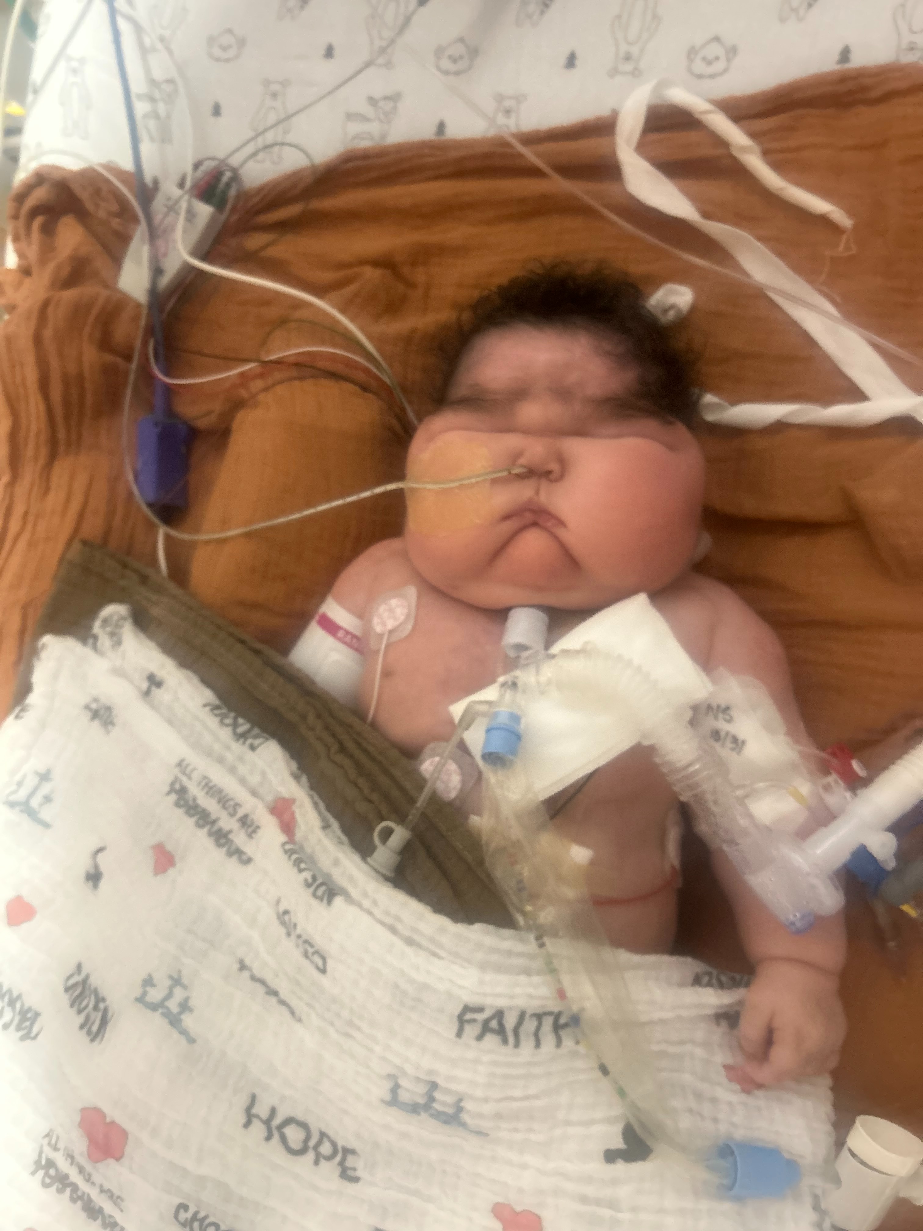 Baby Killian Memorial Fund campaign photo, 2 of 5