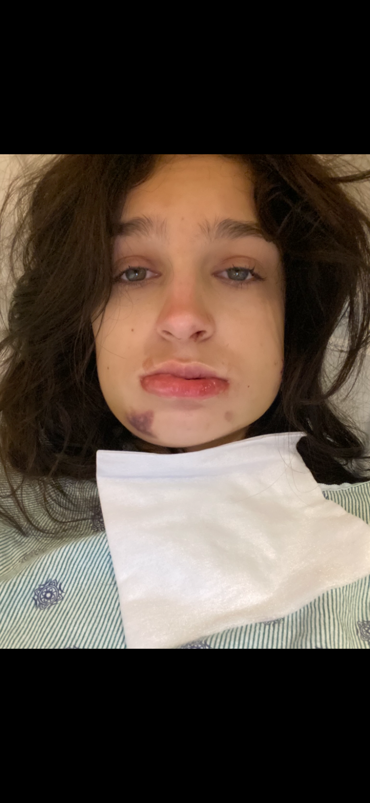 Help Sydney St. Amant Recover from Car Accident campaign photo, 4 of 8