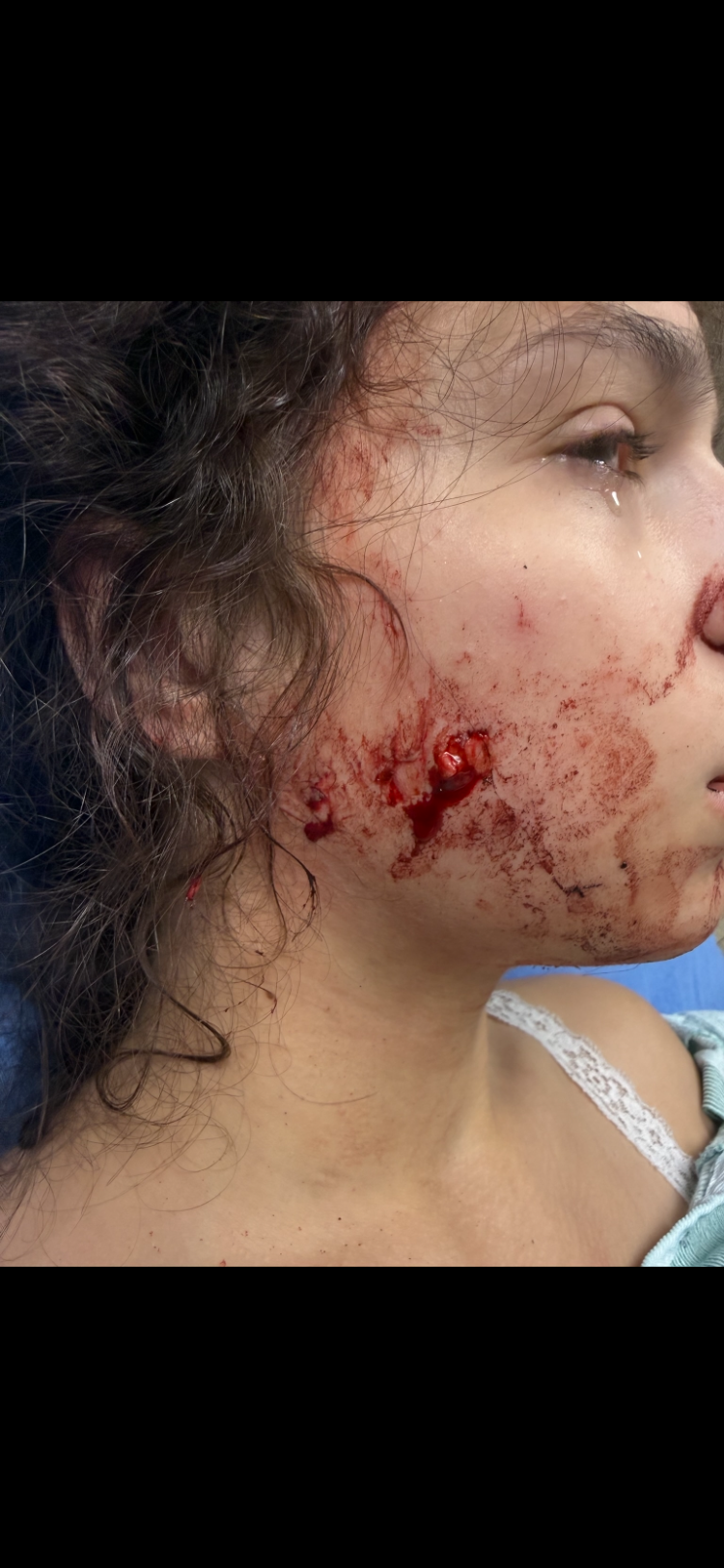 Help Sydney St. Amant Recover from Car Accident campaign photo, 5 of 8