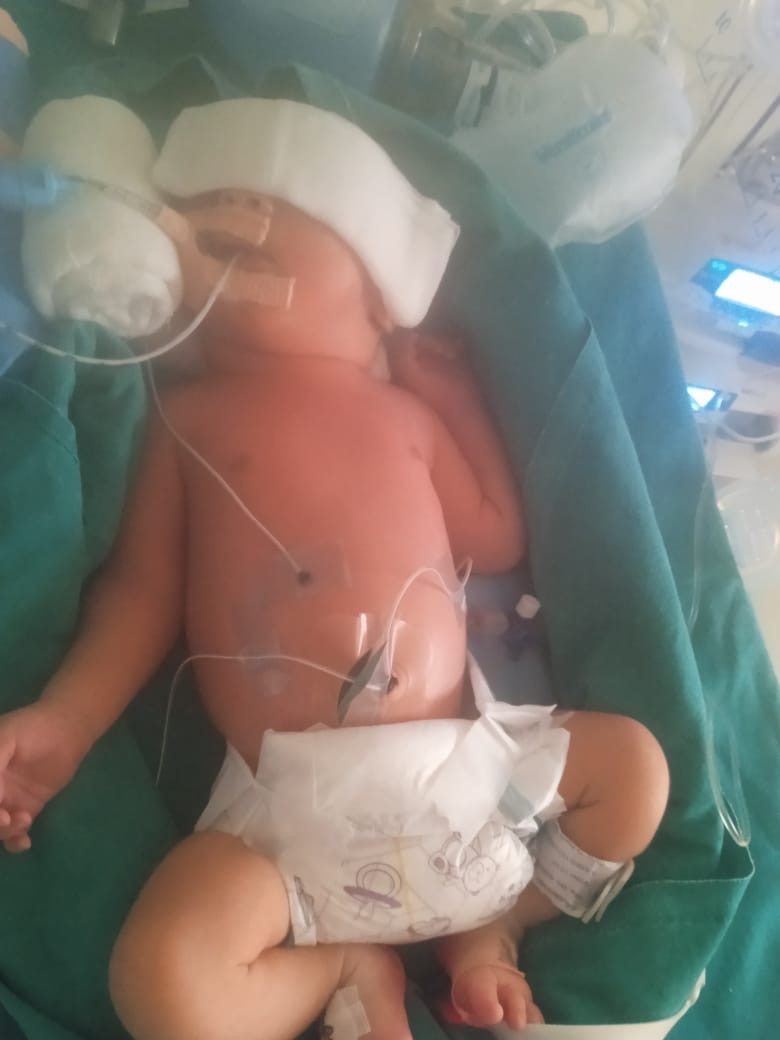 Help Us Save Our Newborn Baby’s Life – Urgent Medical Suppor campaign photo, 2 of 4
