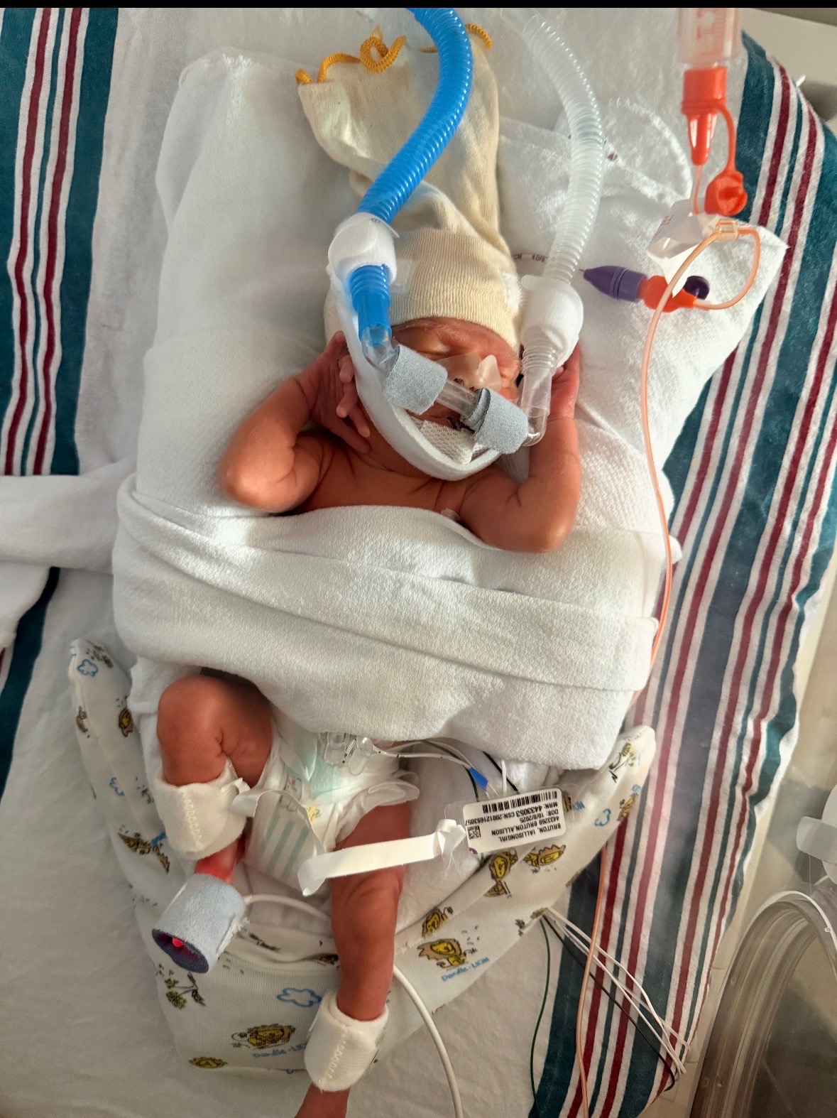 Support Lainey's NICU Journey campaign photo, 2 of 8