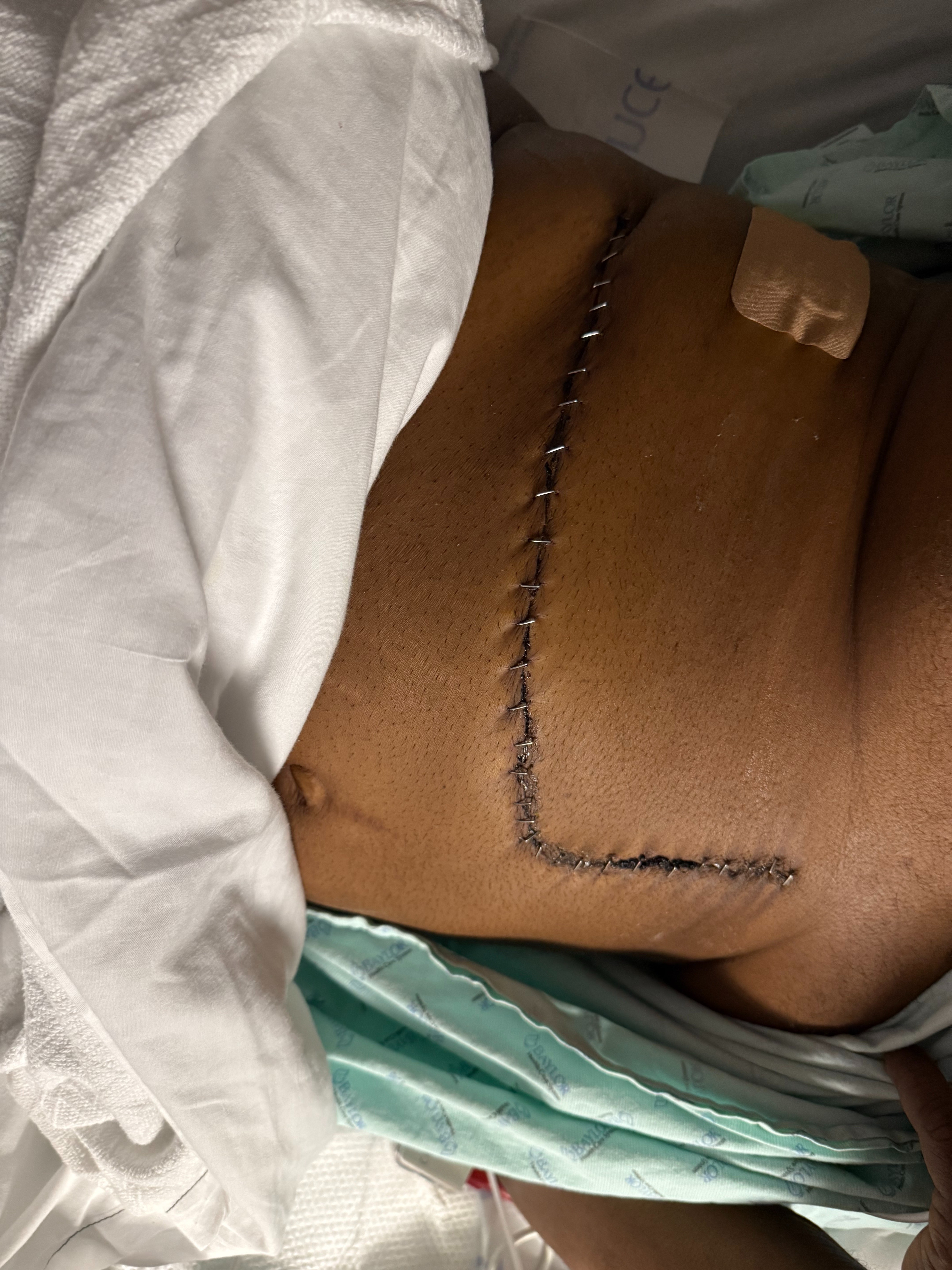 Donate to Johnny Rushing's Life-Saving Journey campaign photo, 4 of 5