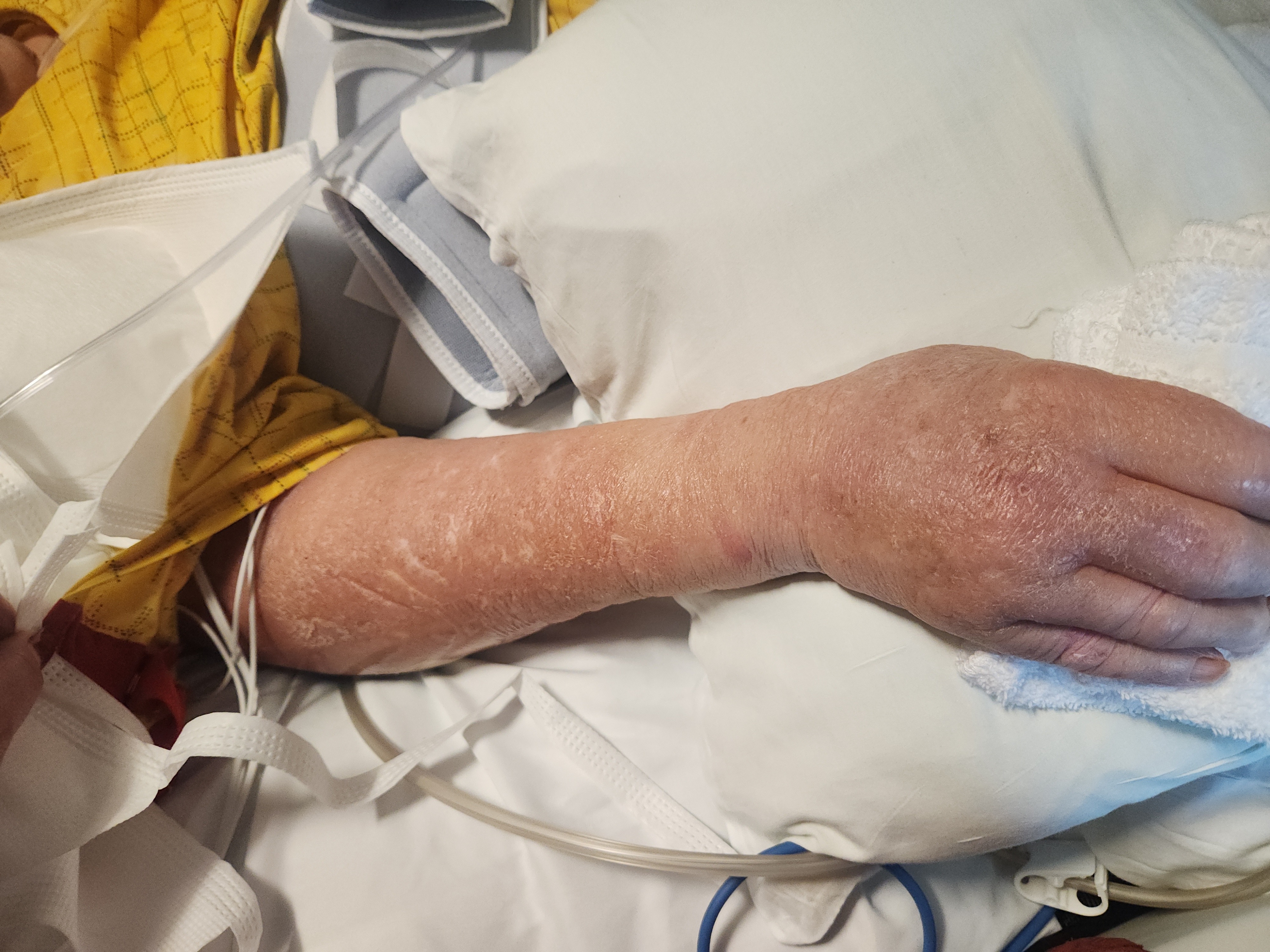 Assist Mom's Recovery: Urgent Need campaign photo, 4 of 6