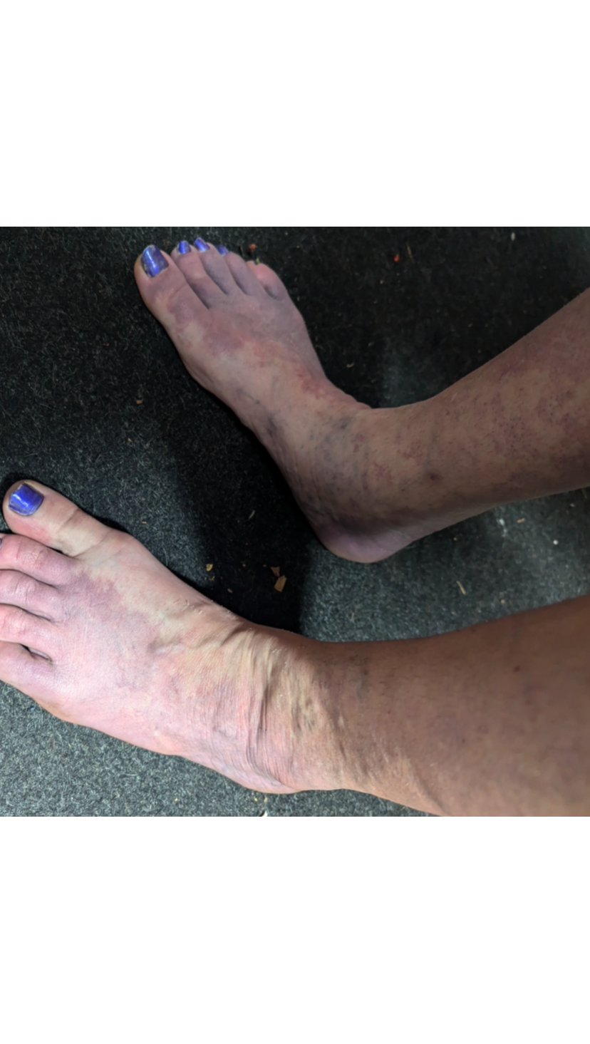 Please Help Access Specialists 4 Rare and Painful Conditions