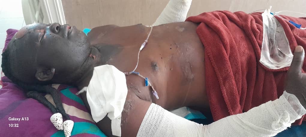 Help John — Himba Leader Severely Burnt in Gas Explosion campaign photo, 2 of 7