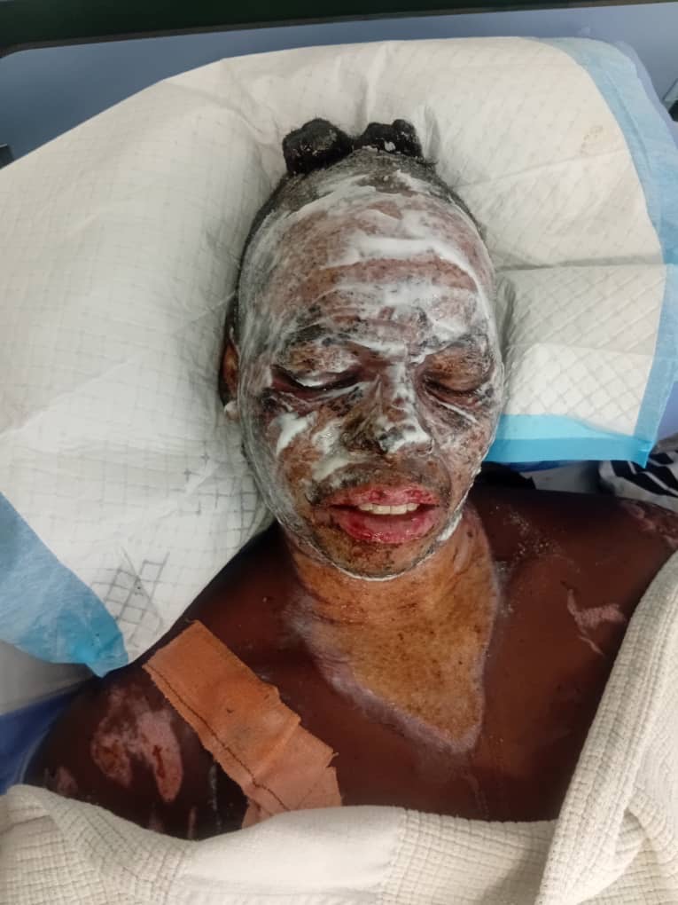 Help John — Himba Leader Severely Burnt in Gas Explosion campaign photo, 4 of 7