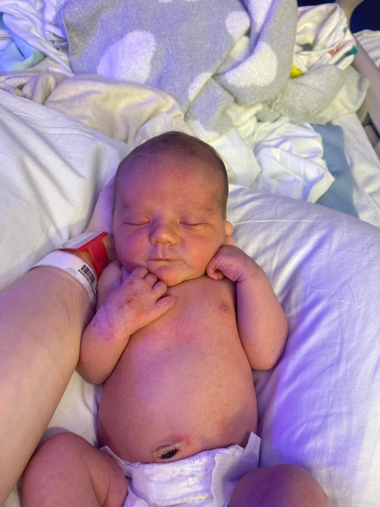 Help us say goodbye to Wyatt after devastating fire campaign photo, 2 of 4