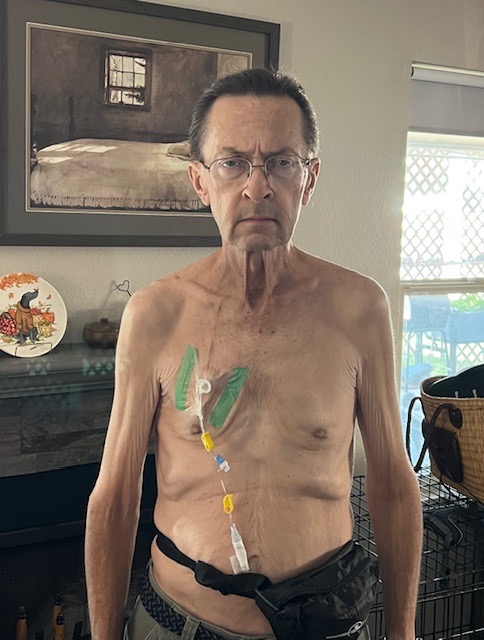 Support Gordon Byrn's Fight Against Pancreatic Cancer campaign photo, 4 of 6