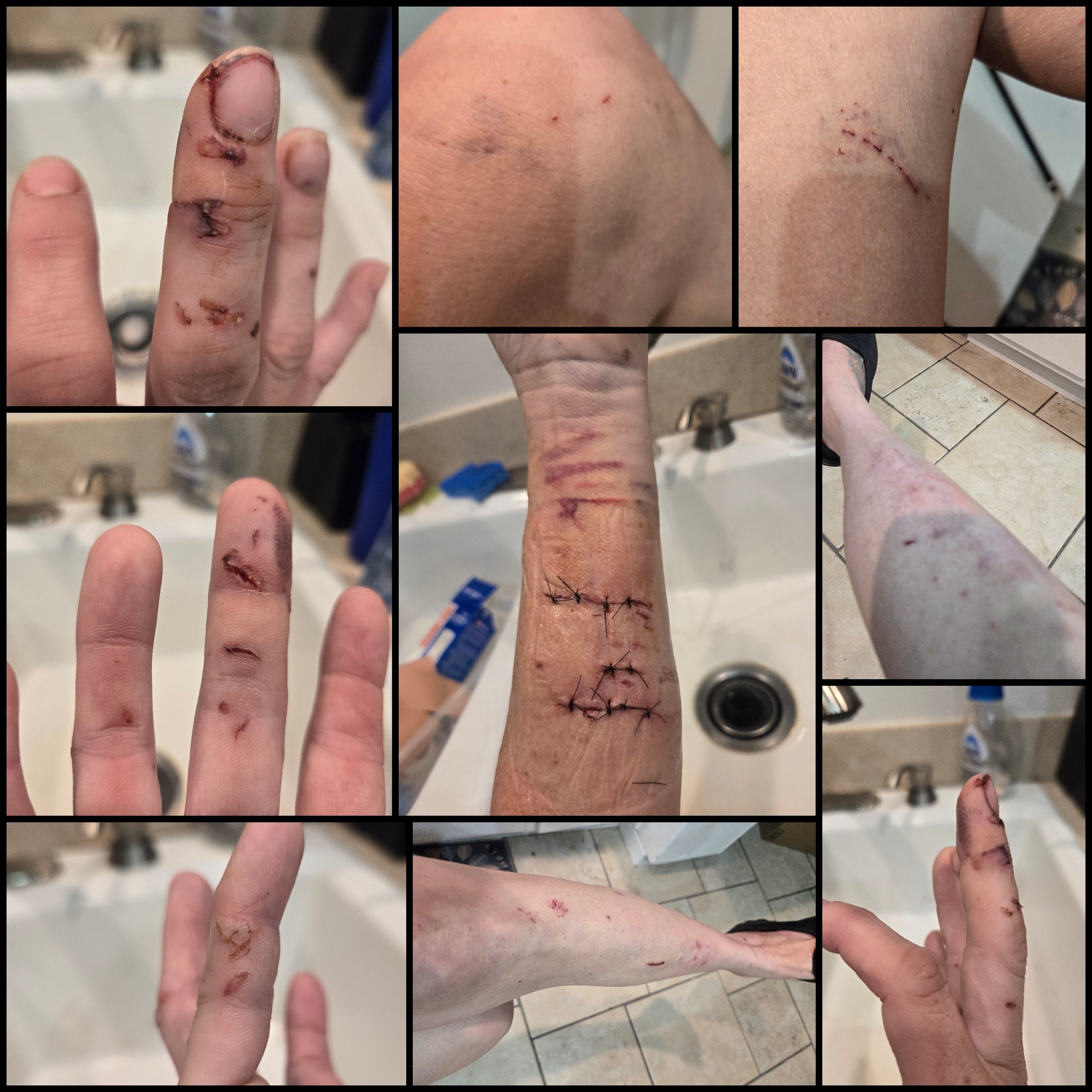 Donate to Lori and Sarah's Healing Journey campaign photo, 5 of 7