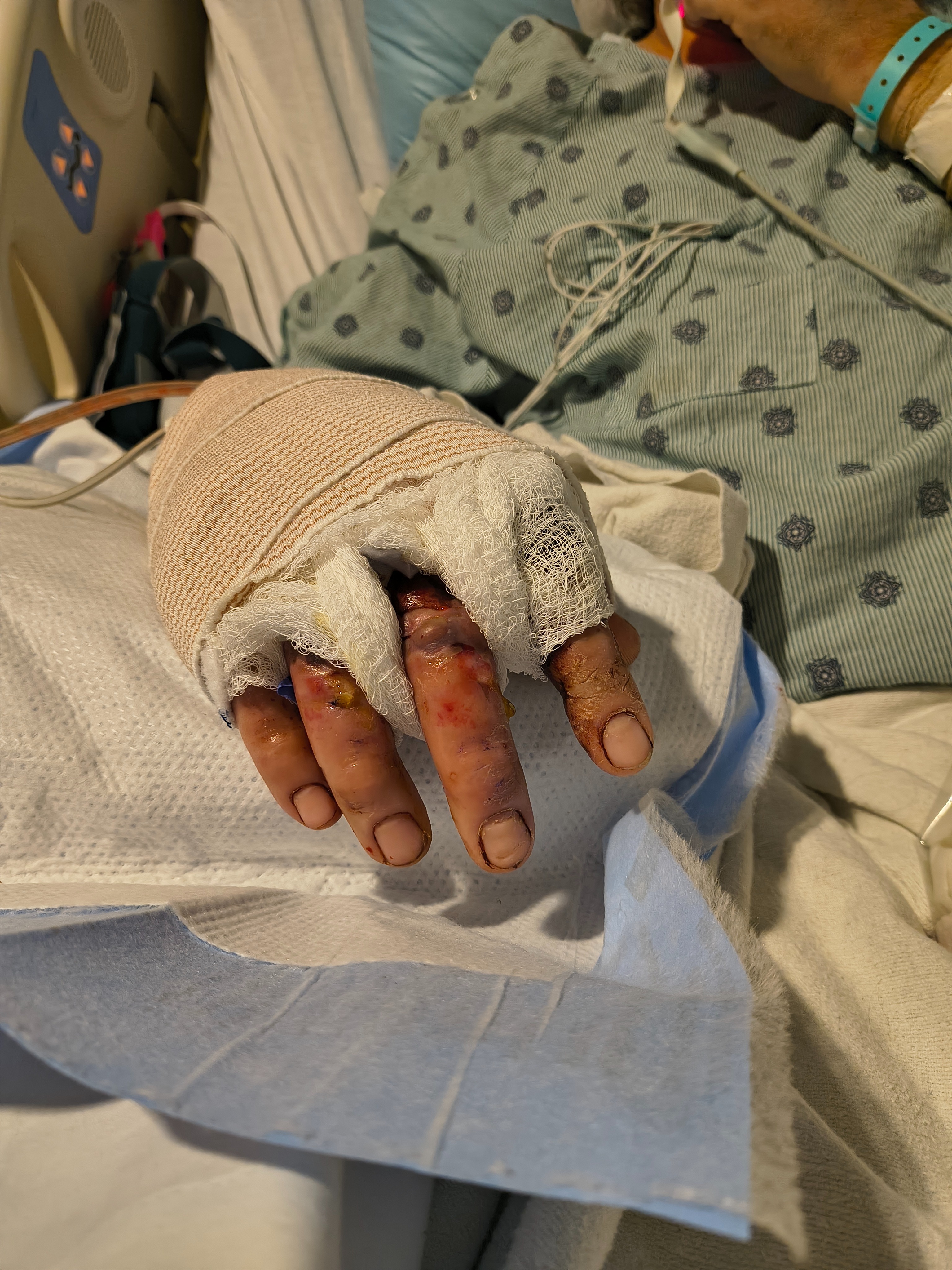 Support James Lamb's Long Road to Recovery campaign photo, 7 of 8