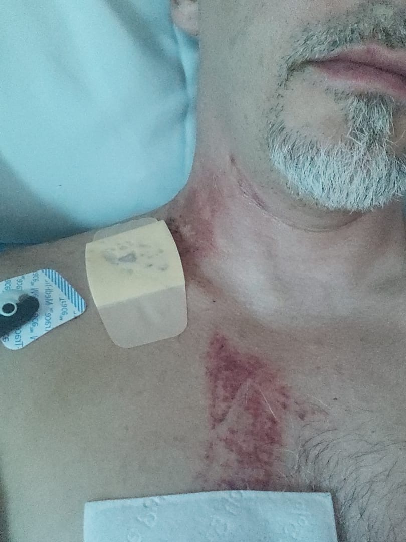 Support Leo’s Recovery After Motorcycle Accident campaign photo, 6 of 7