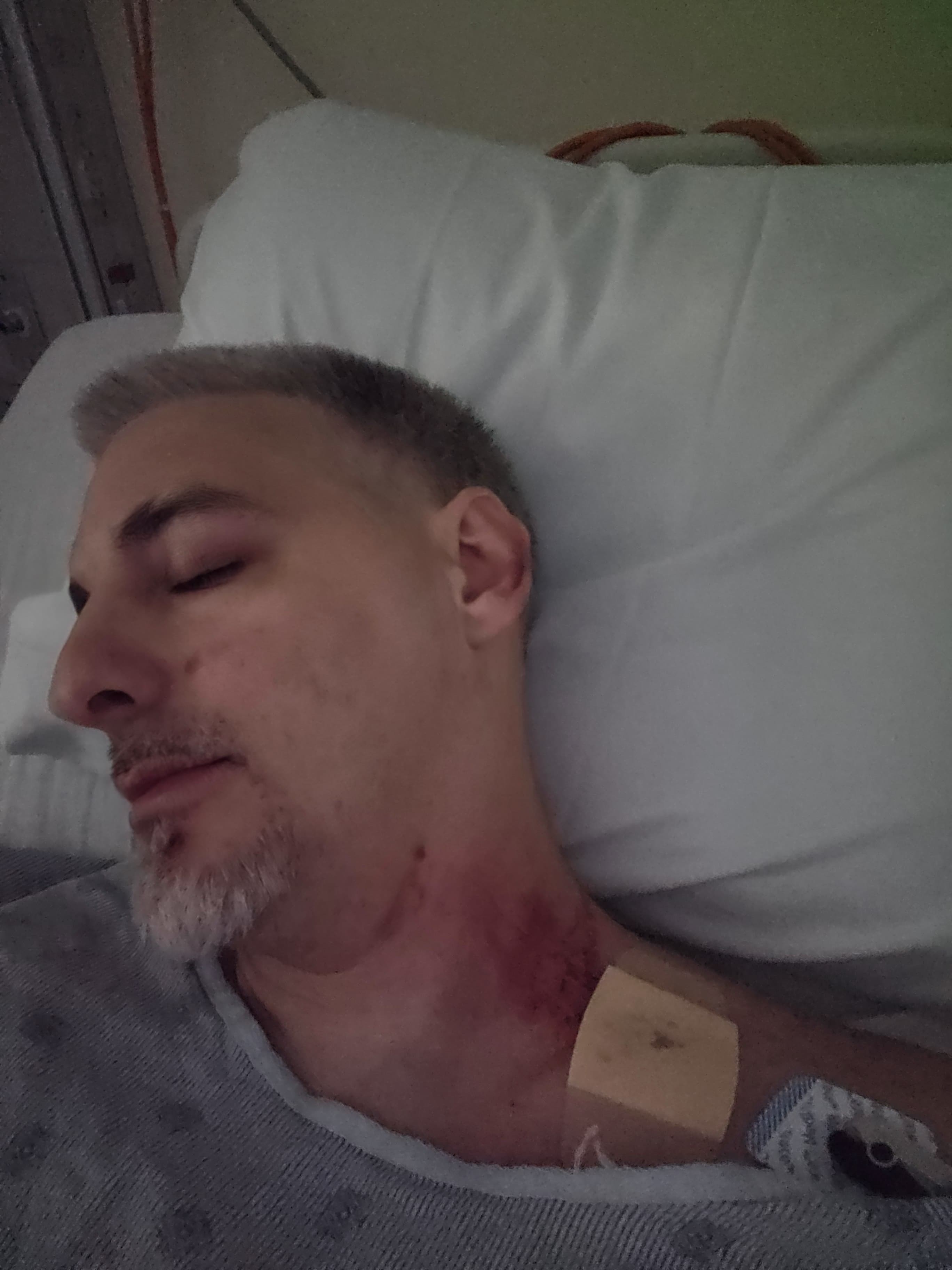 Support Leo’s Recovery After Motorcycle Accident campaign photo, 2 of 7