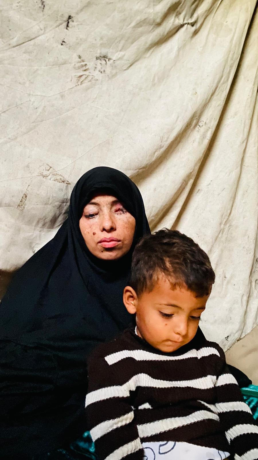 Sostieni Rawan e suo figlio – Da Gaza, per la speranza campaign photo, 2 of 6