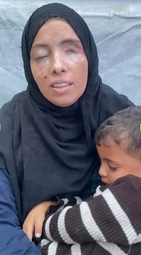 Sostieni Rawan e suo figlio – Da Gaza, per la speranza campaign photo, 4 of 6