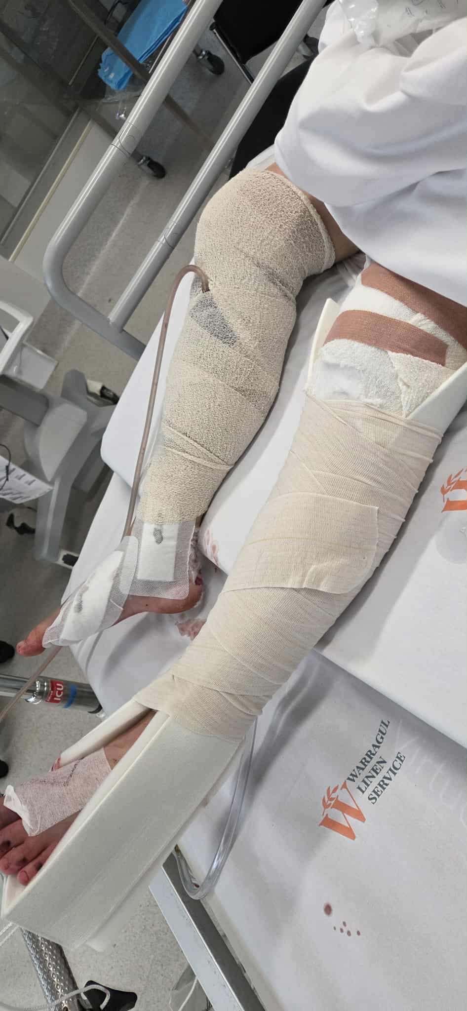 Please Help Our Niece After a Terrible Accident in Australia campaign photo, 6 of 8