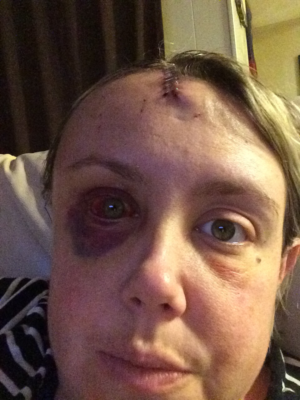 Support Jamie's Fight Against Glioblastoma campaign photo, 7 of 8