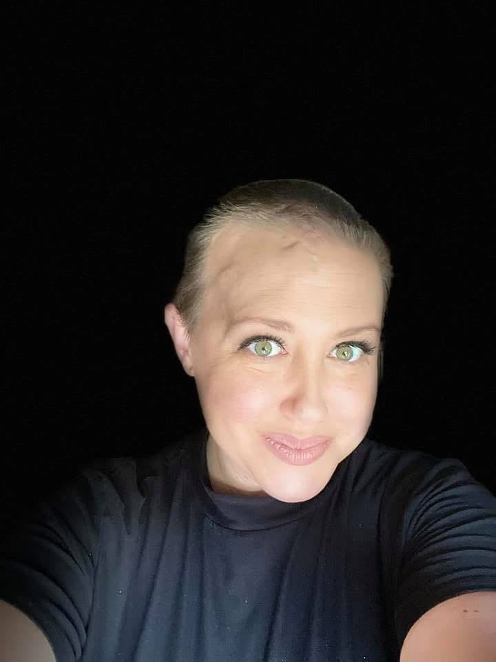 Support Jamie's Fight Against Glioblastoma campaign photo, 4 of 8