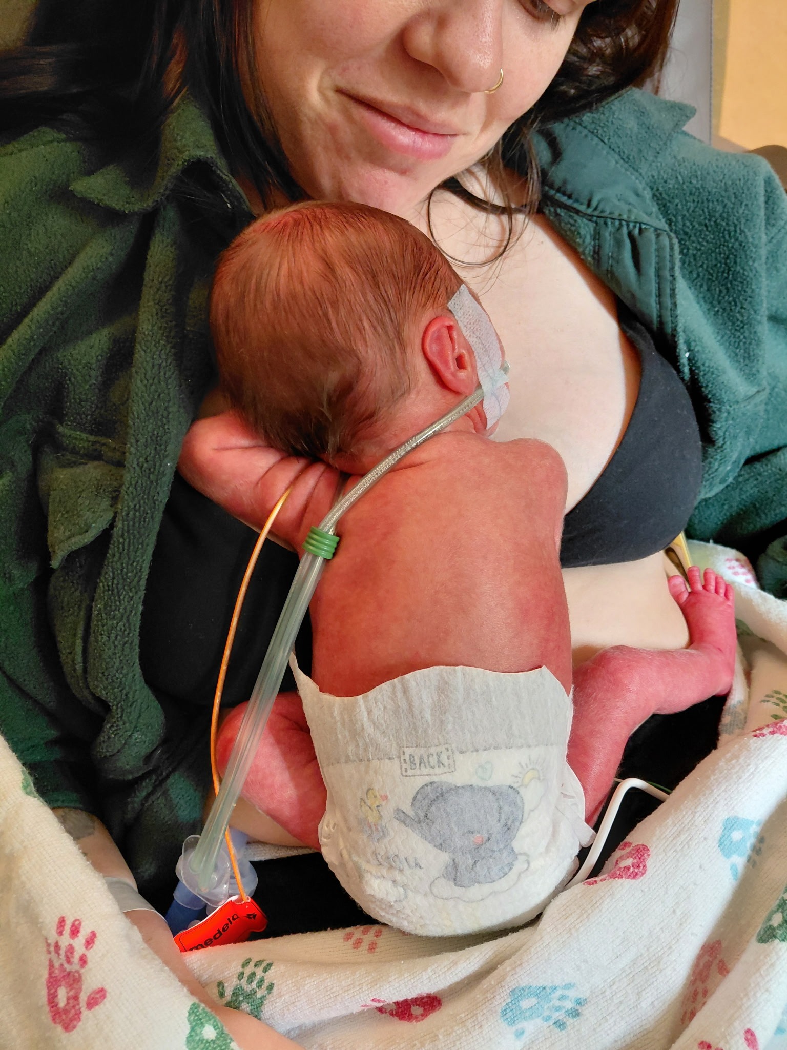 Support Baby Clementine's NICU Journey campaign photo, 4 of 8