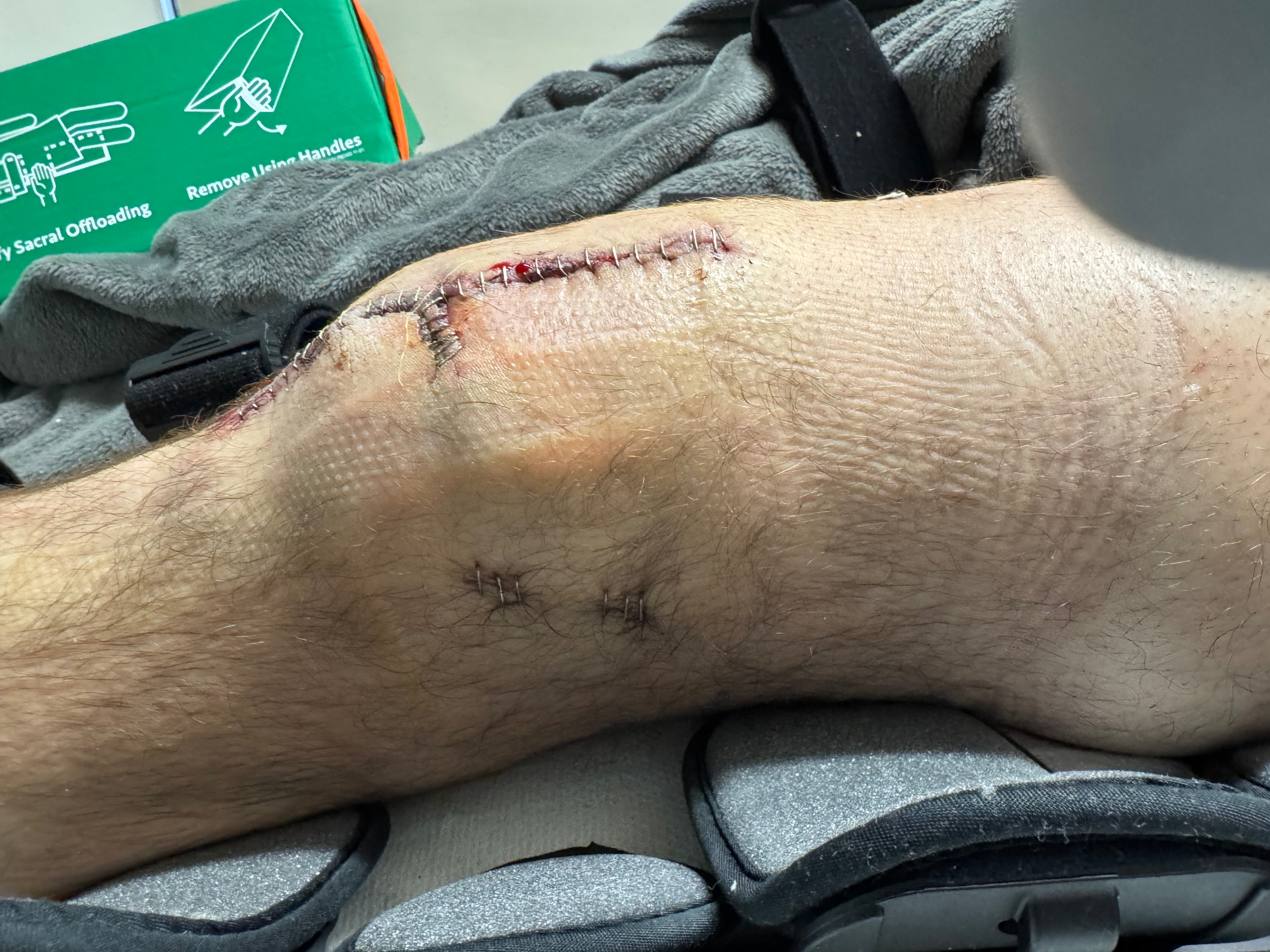 Support Jesse Sisk's Road to Recovery campaign photo, 4 of 8