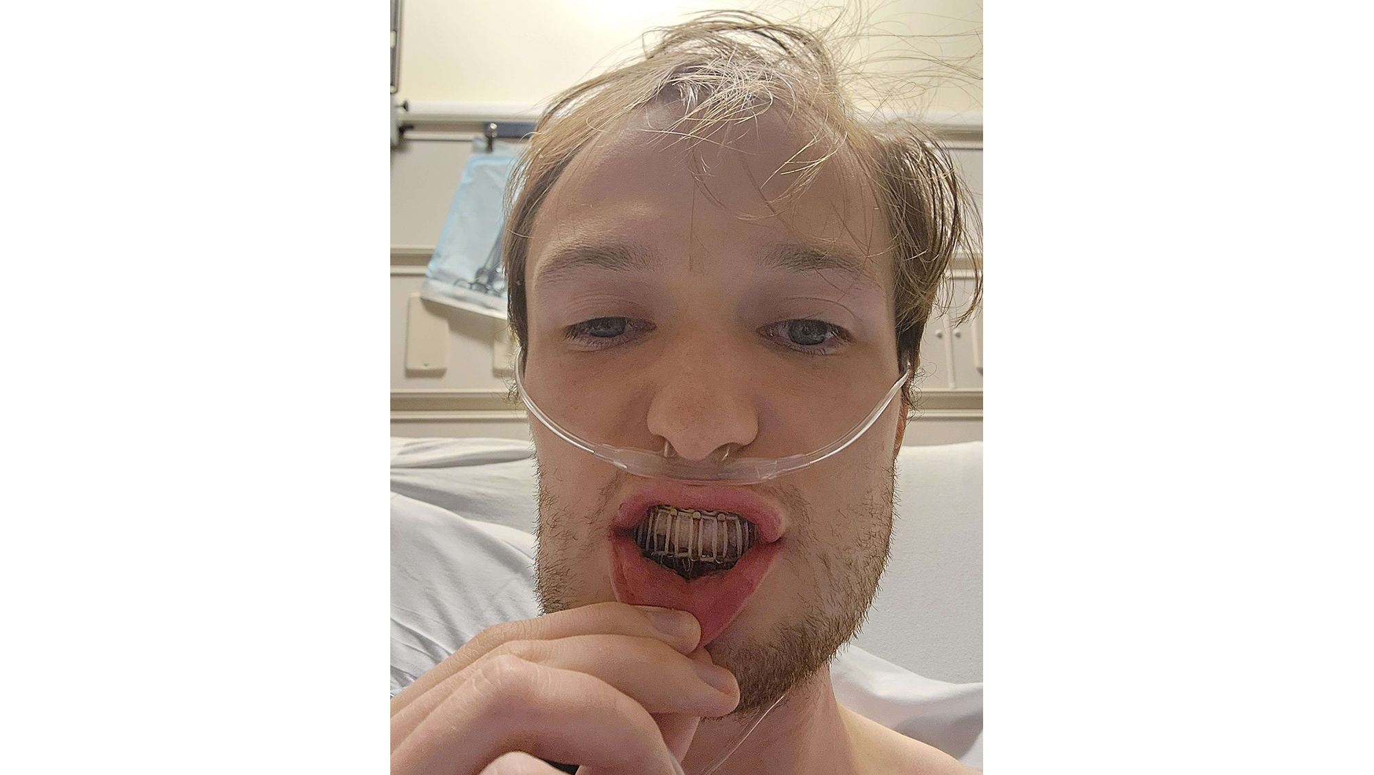 Help Thomas Heal After Unprovoked Attack photo