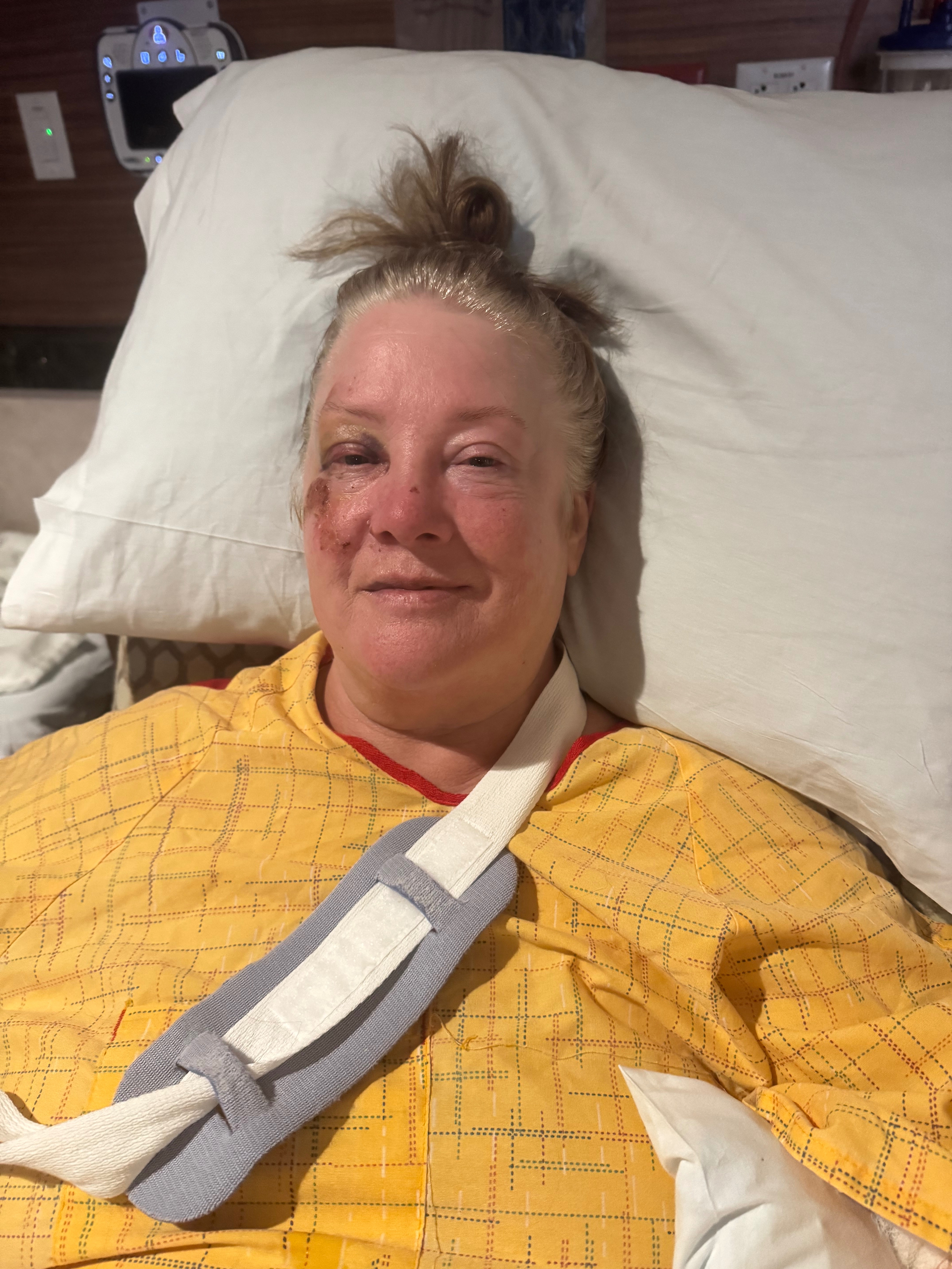 Help My Mom Rebuild Her Life After a Devastating Fall campaign photo, 5 of 8