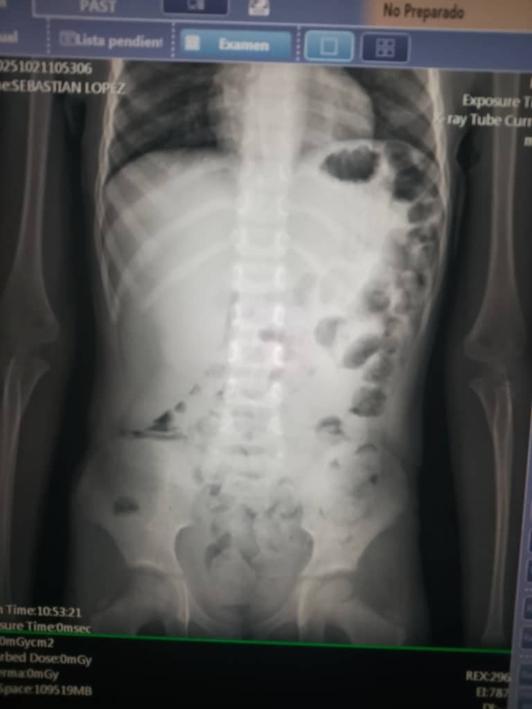 Help Sebastian Lopez Fight Kidney Cancer campaign photo, 4 of 7