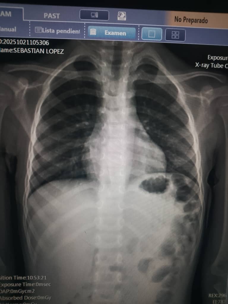 Help Sebastian Lopez Fight Kidney Cancer campaign photo, 5 of 7