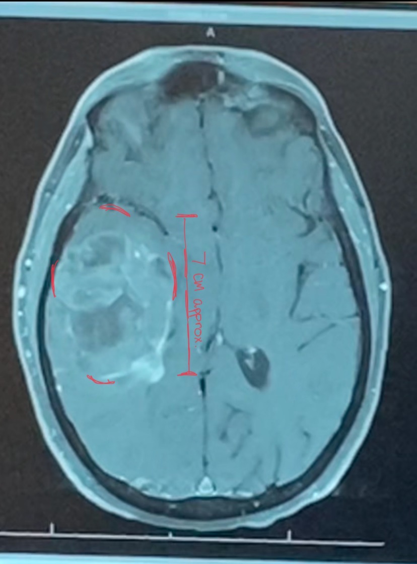 Donate to Kevin Miller's Medical Recovery campaign photo, 7 of 8